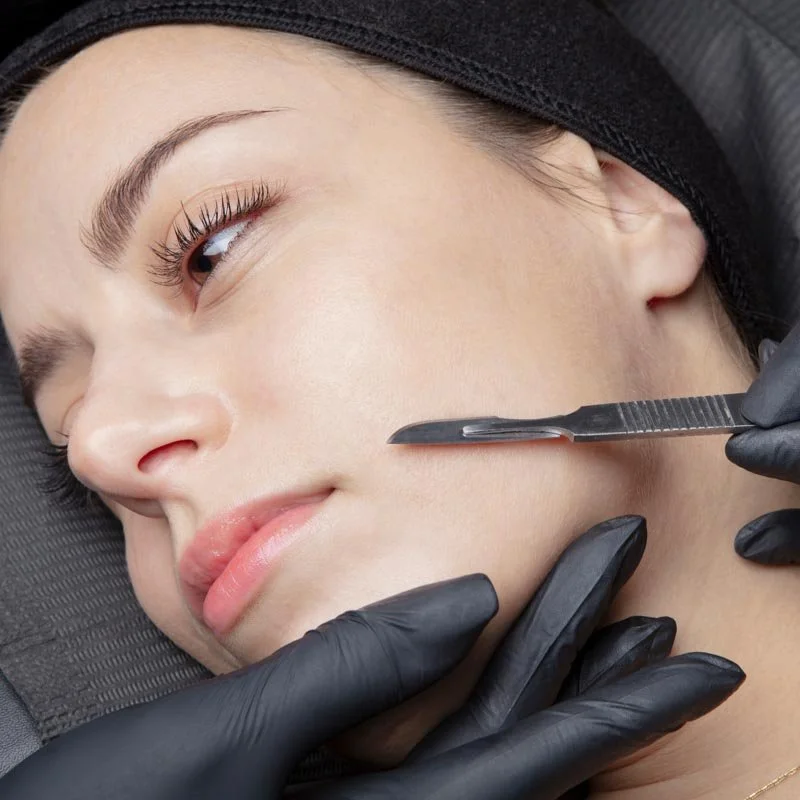 Close-up of a woman receiving an in-depth facial treatment, with a dermatologist using a scalpel on her cheek.