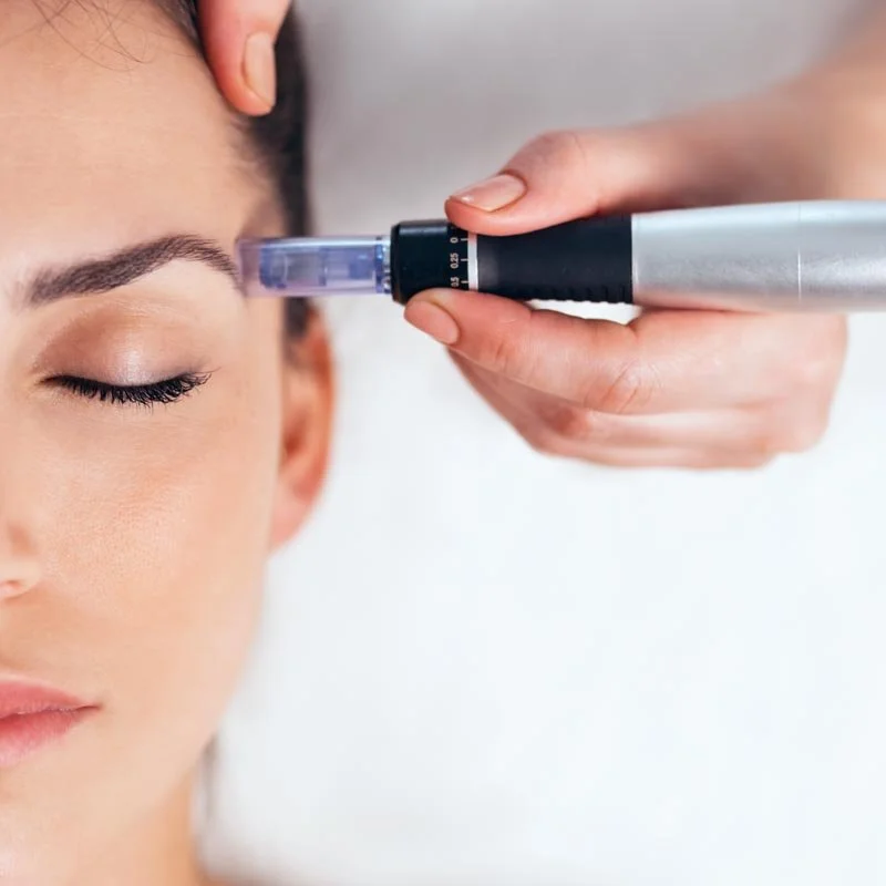 A woman with closed eyes receiving a cosmetic treatment with a handheld device on her forehead.