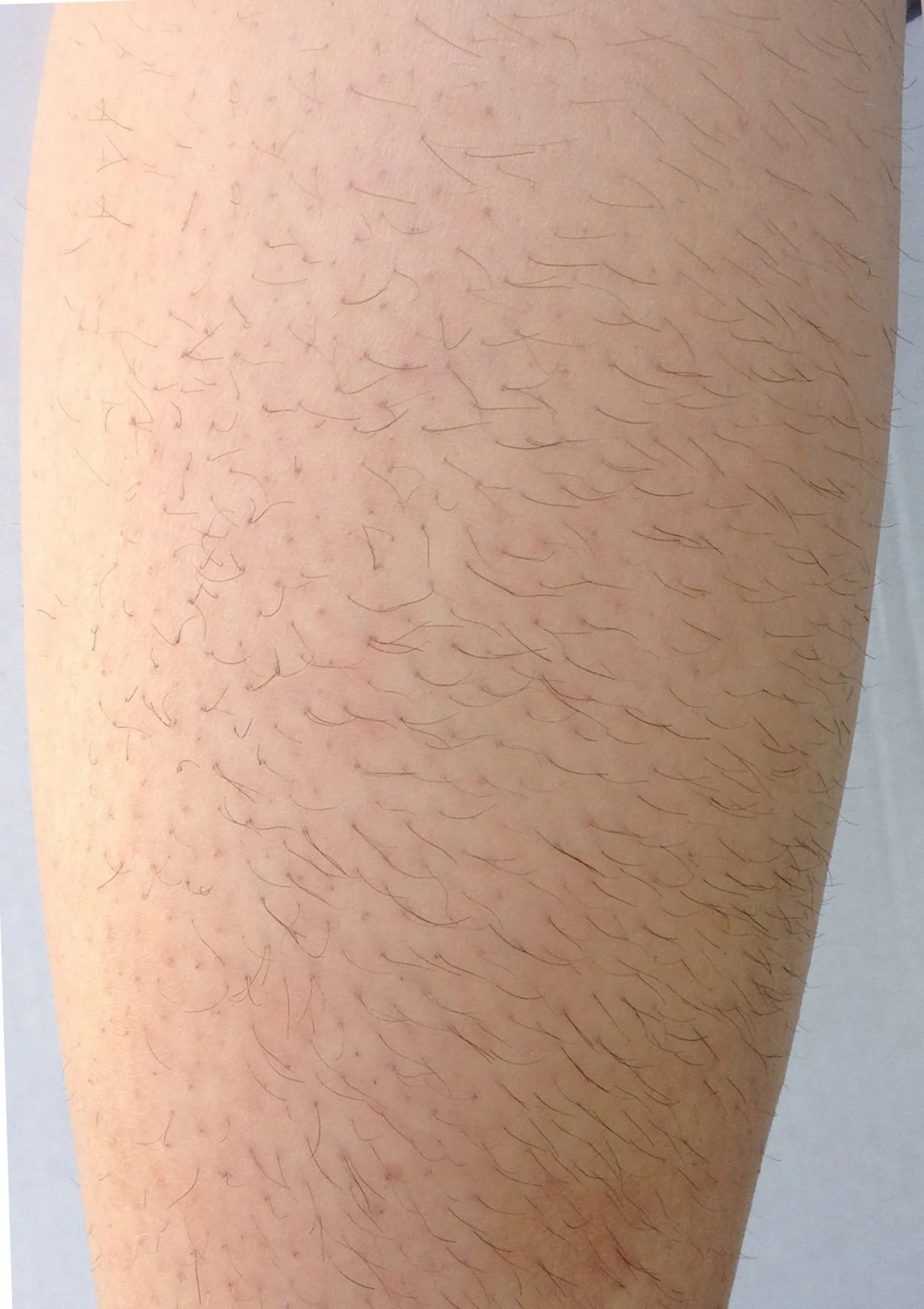 Close-up of a person's leg with light skin, showing natural body hair.