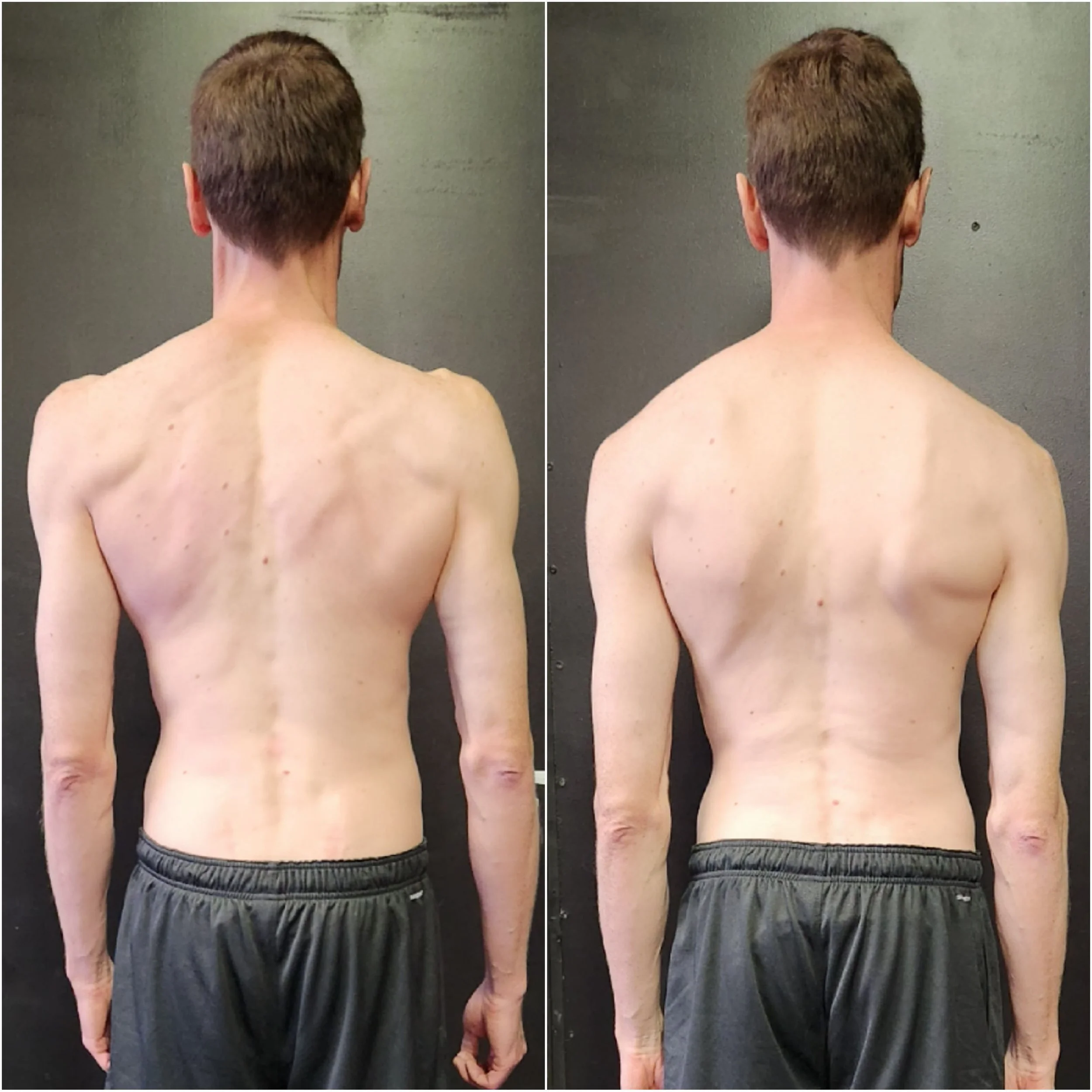 Structural Rebuild Package (16 Sessions)