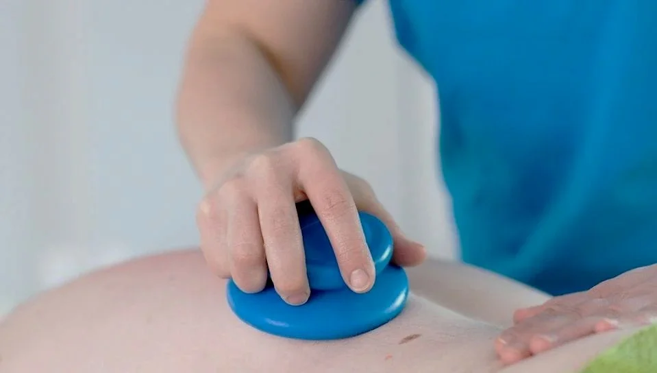 Kuivakuppaus/imukuppihieronta selälle. Kuvassa tekijänä Marko.