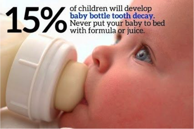 Baby Bottle Tooth Decay