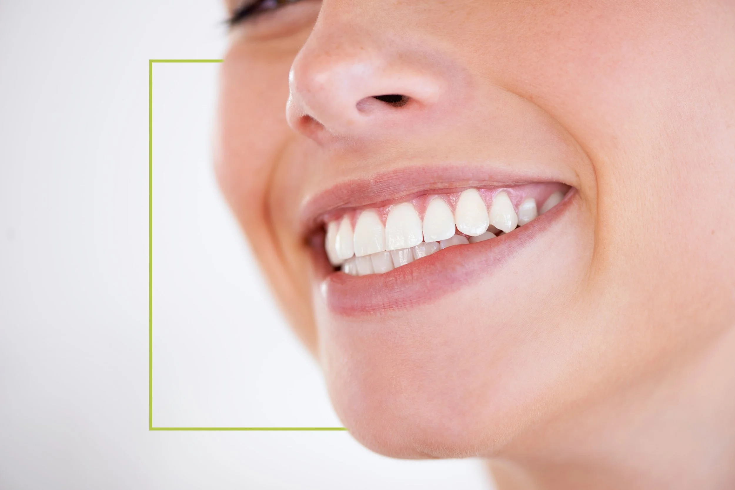 Close-up of a smiling woman's mouth showing white teeth.