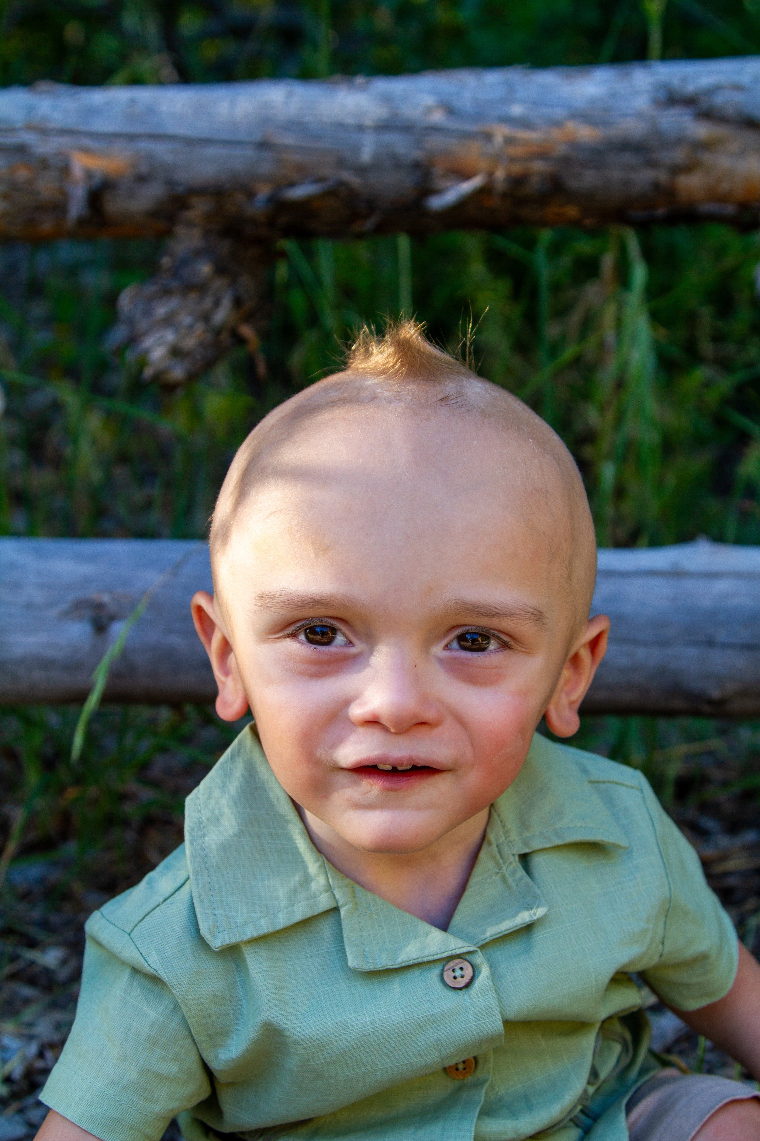 Close-up of a young boy with a bald head and brown eyes, in a green shirt, outdoors with greenery and a wooden fence in the background.