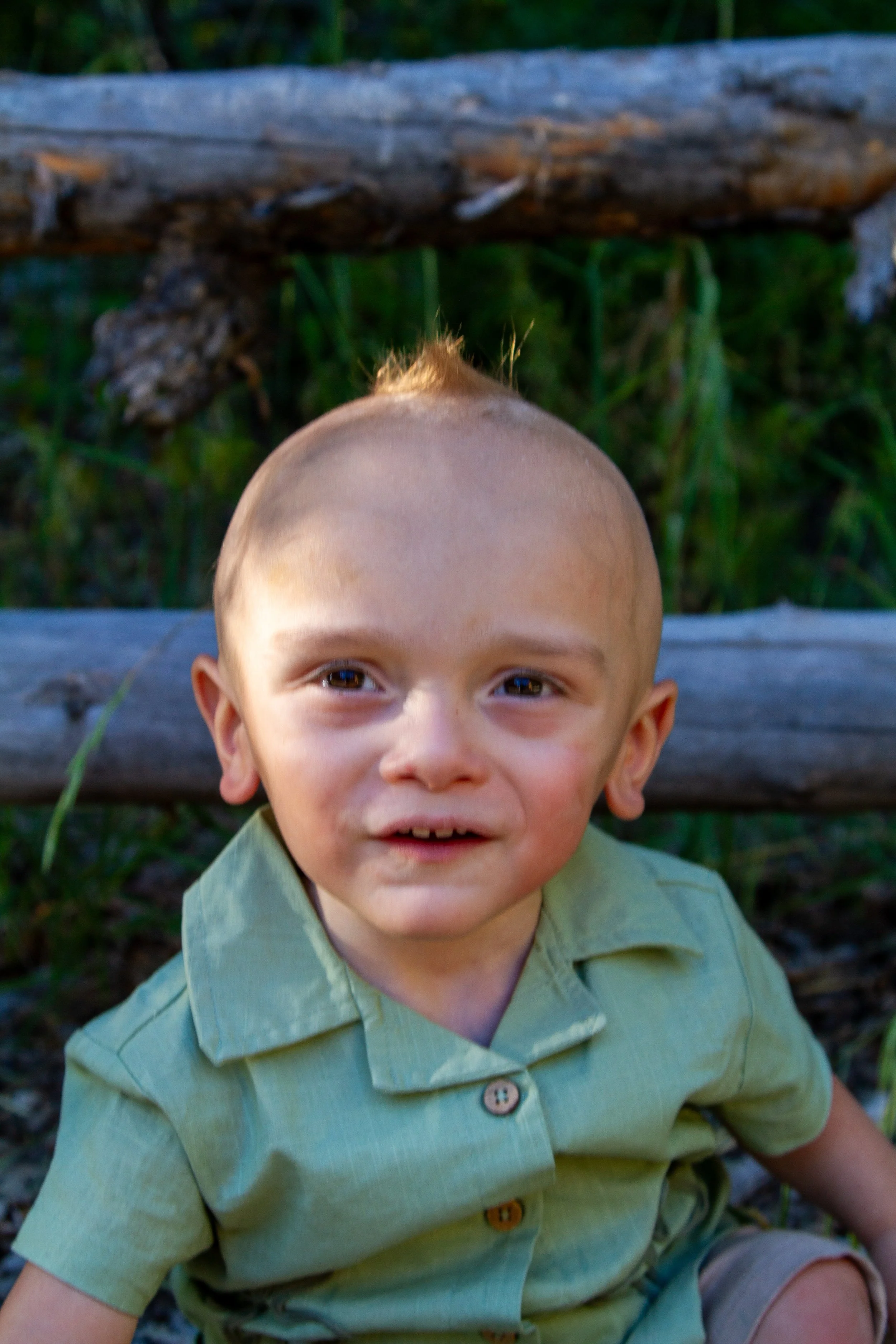 Close-up of a young boy with a bald spot on his head, smiling and sitting outdoors near a wooden bench and greenery.