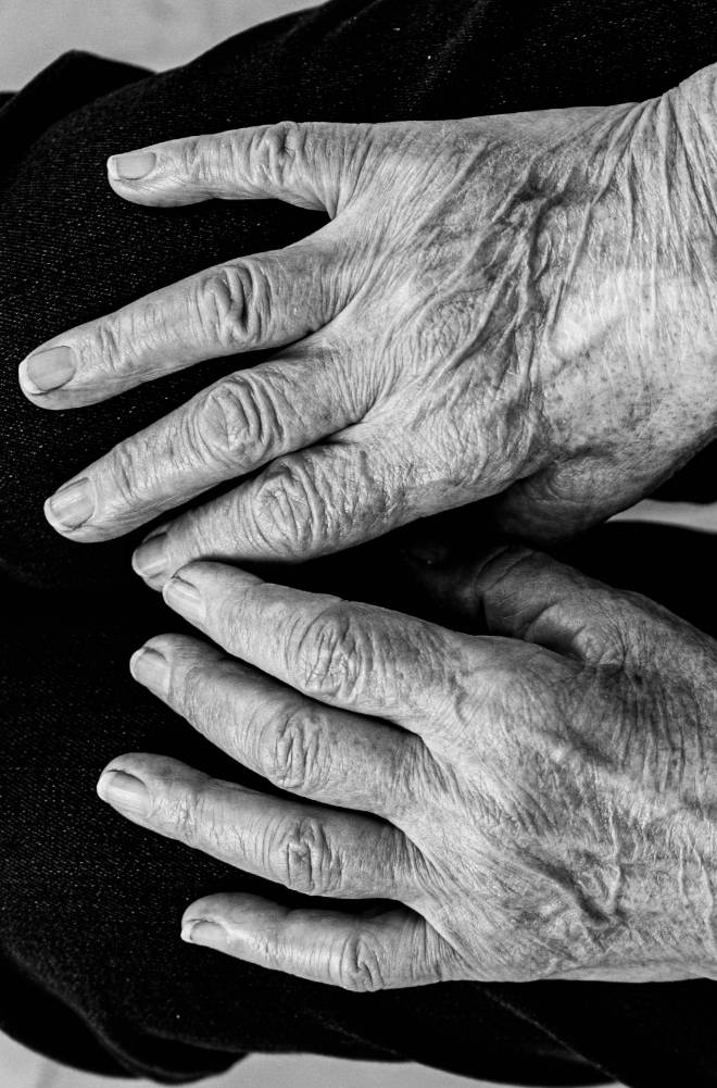Close-up of elderly hands on a black fabric surface, showing wrinkles and age spots.
