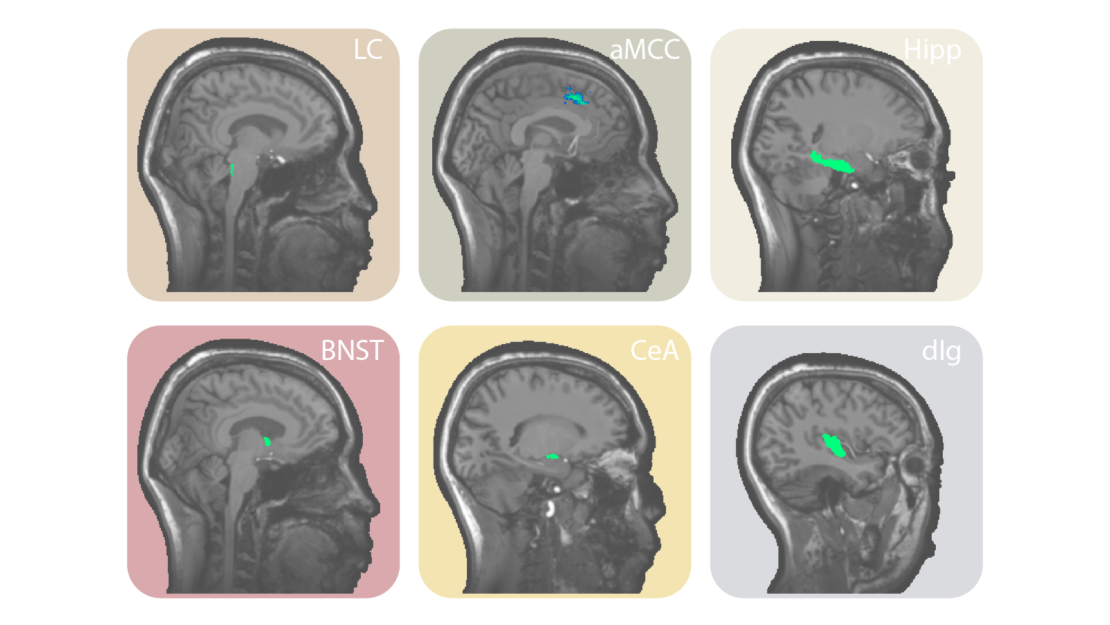 Causal Manipulation of Neural Computations