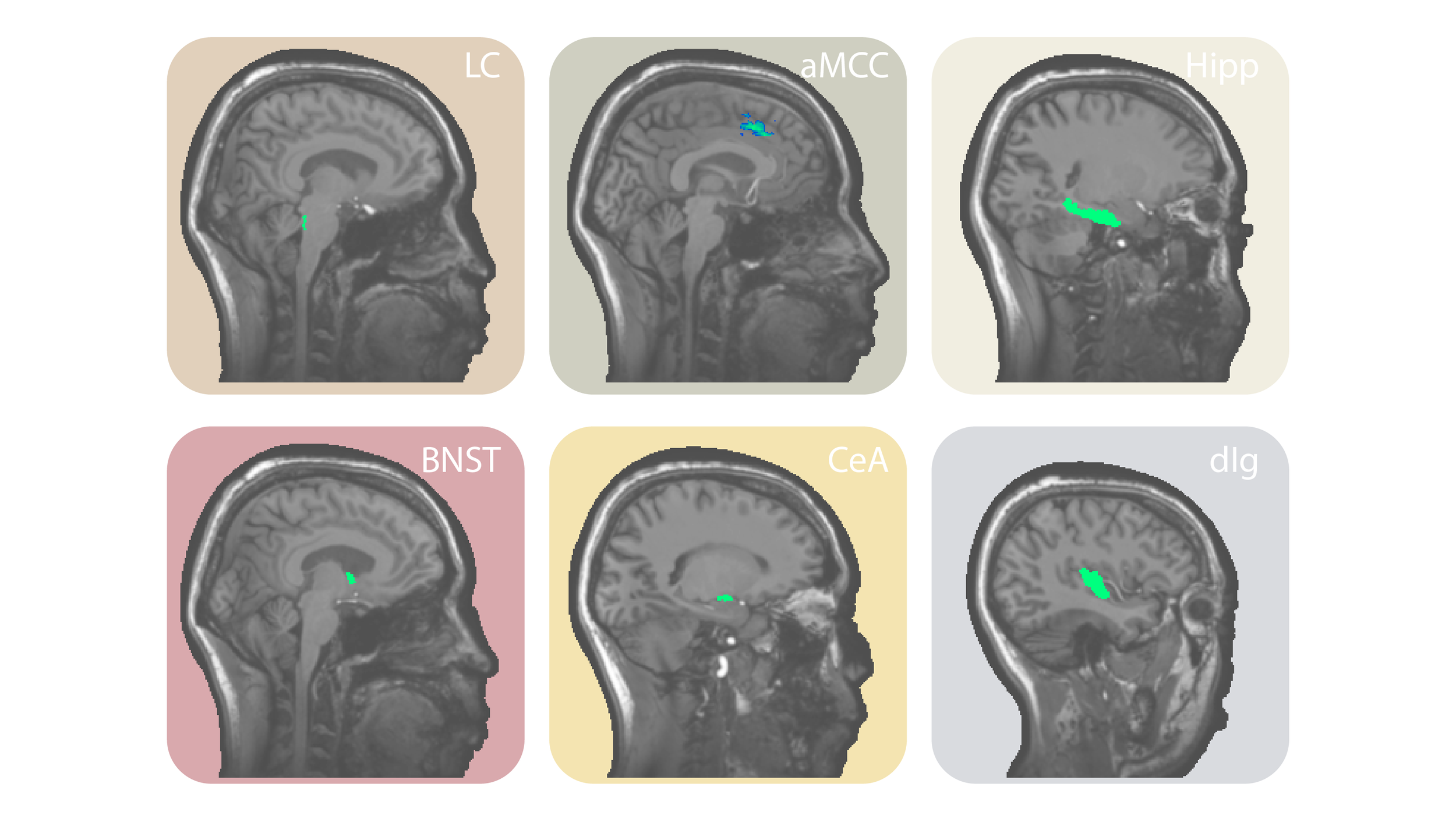Causal Manipulation of Neural Computations