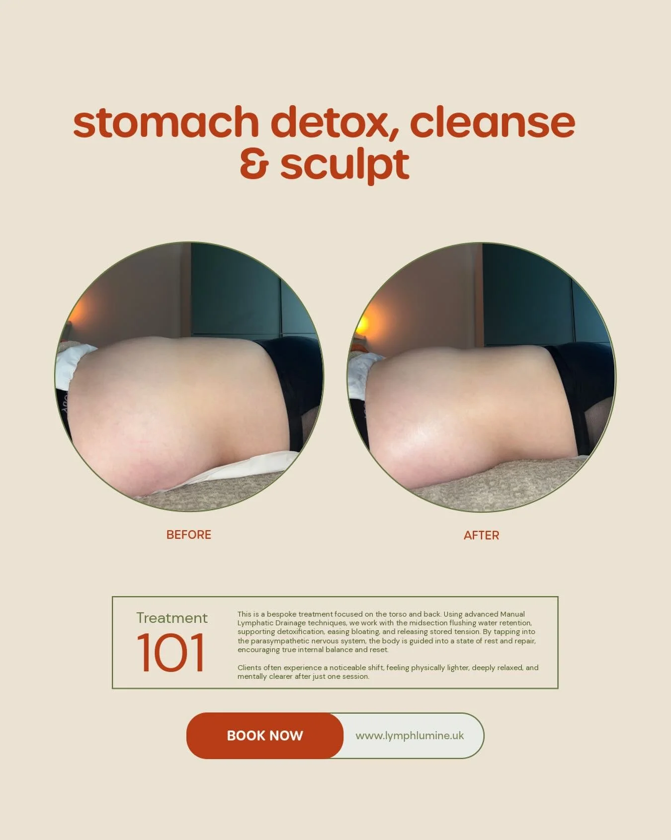 TREATMENT 101 ⚡️
Stomach Detox, Cleanse &amp; Sculpt // 50 mins // Home visits &amp; Oru Dulwich. 

This is a bespoke treatment focused on the torso and back. Using advanced Manual Lymphatic Drainage techniques, we work with the midsection flushing w