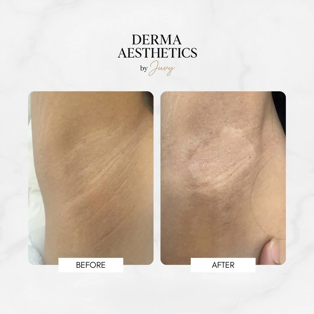 Before and After Template (1).jpg