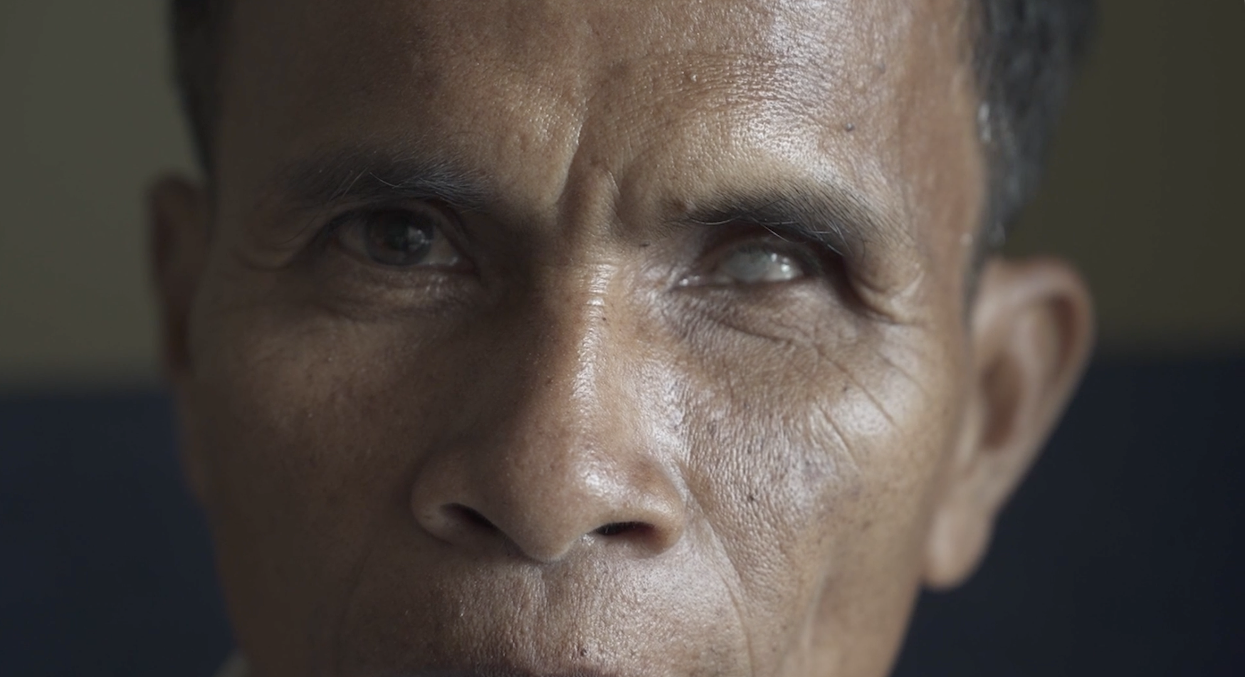 Close-up of an elderly person's face with a focus on their eyes and forehead.