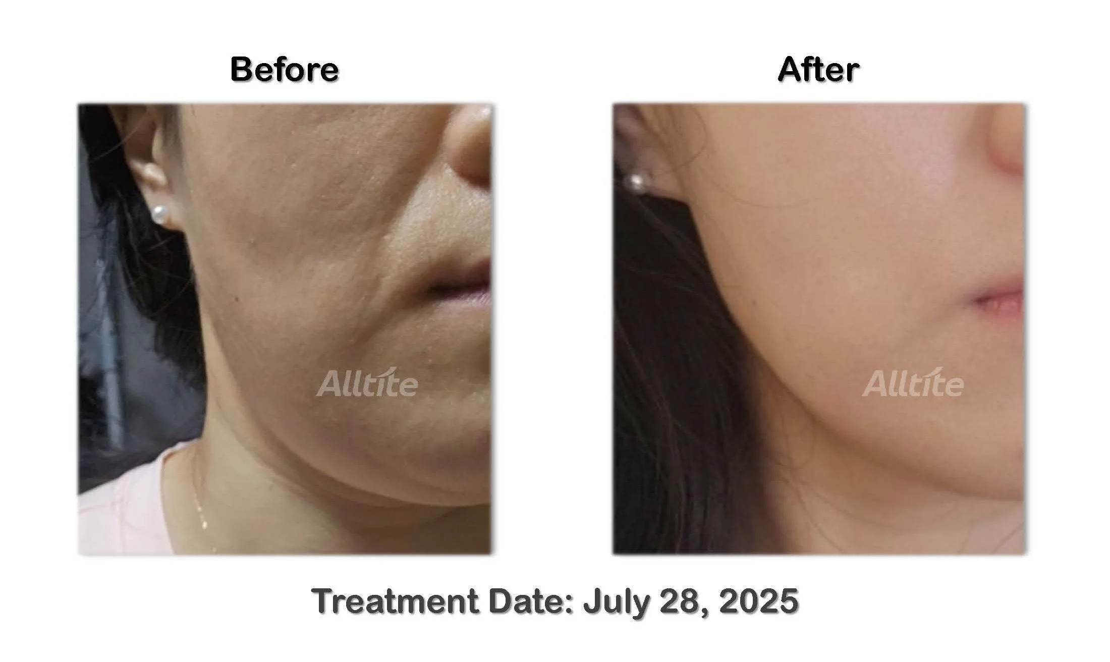 before and After (outgoing)_페이지_12.jpg