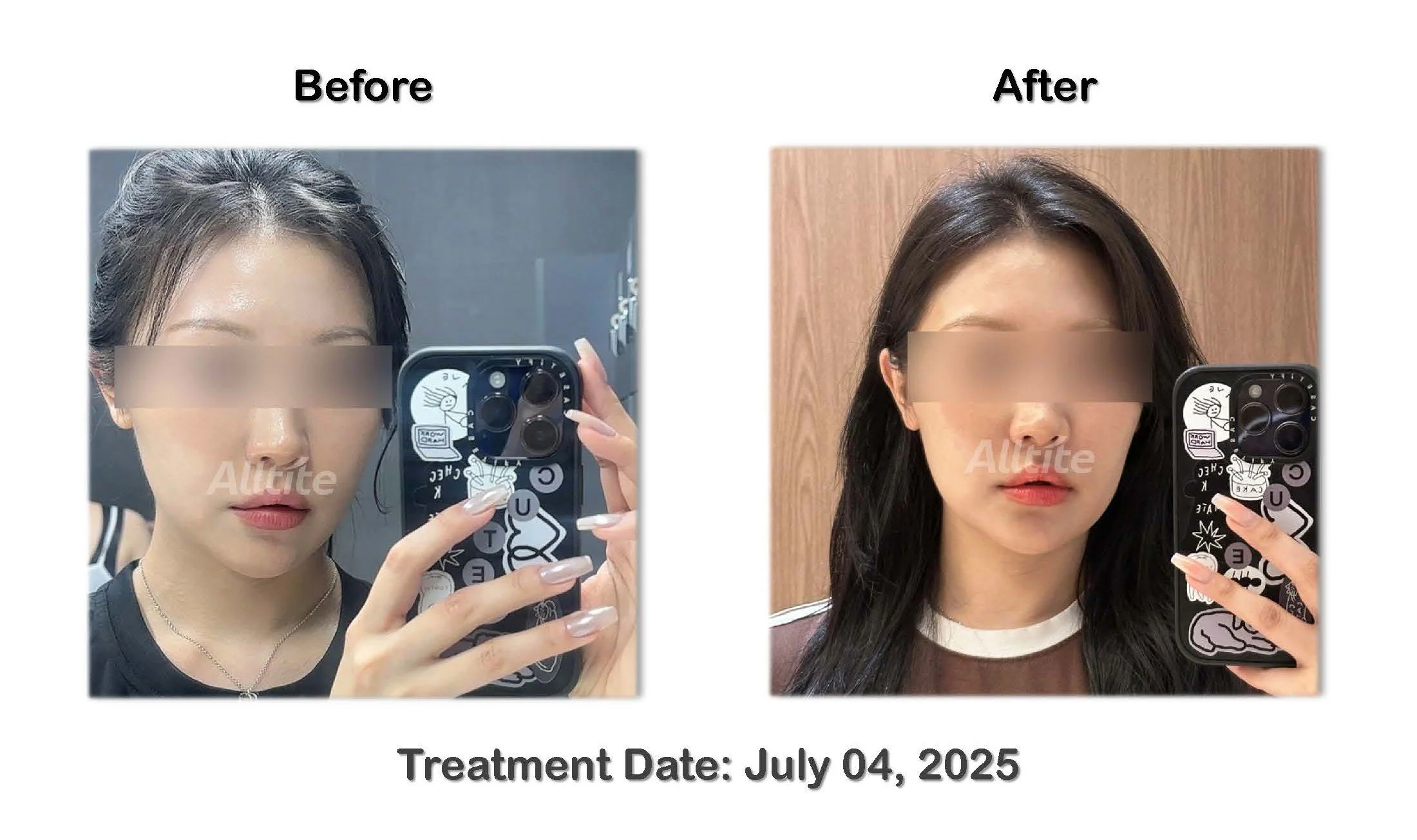 before and After (outgoing)_페이지_07.jpg