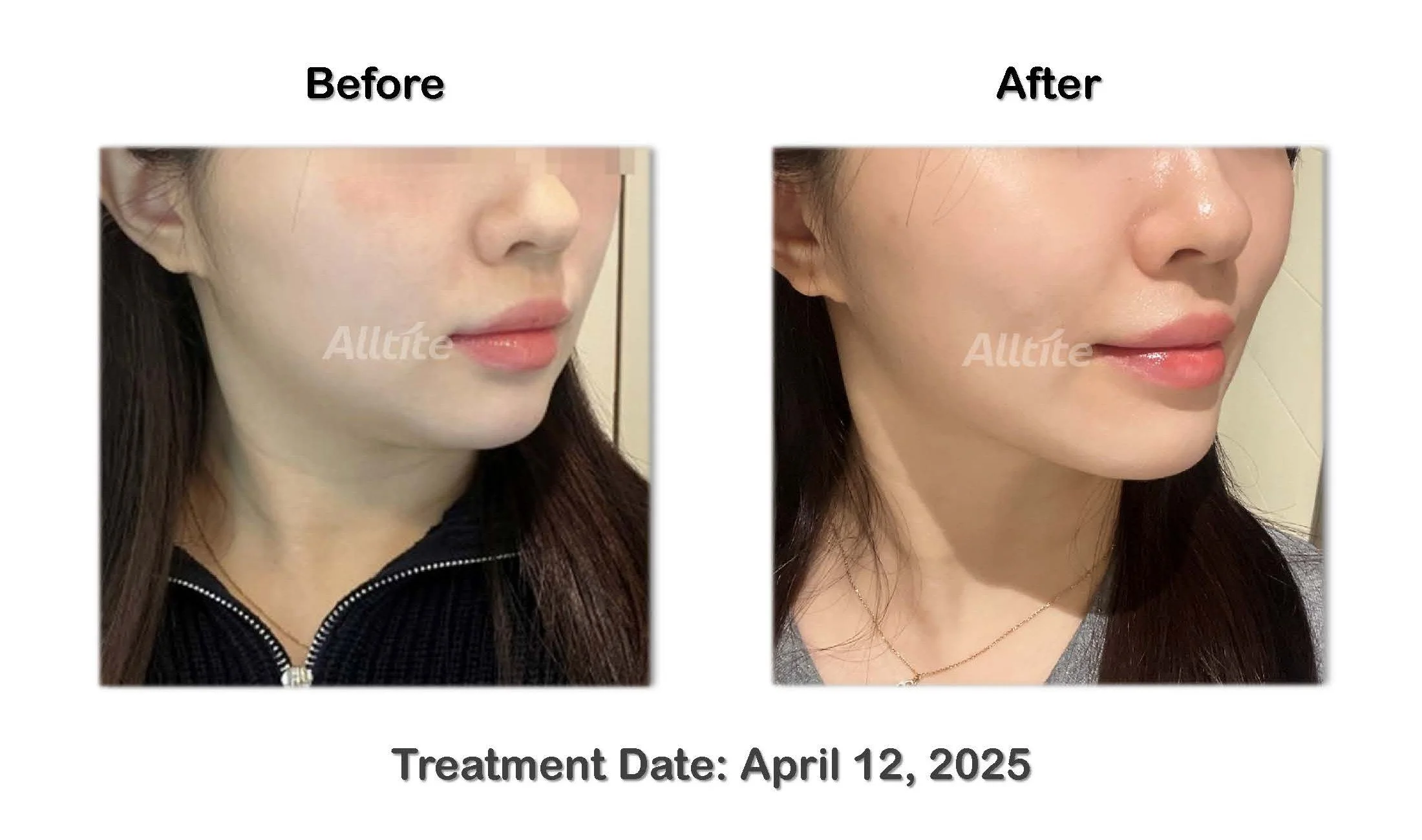 before and After (outgoing)_페이지_06.jpg