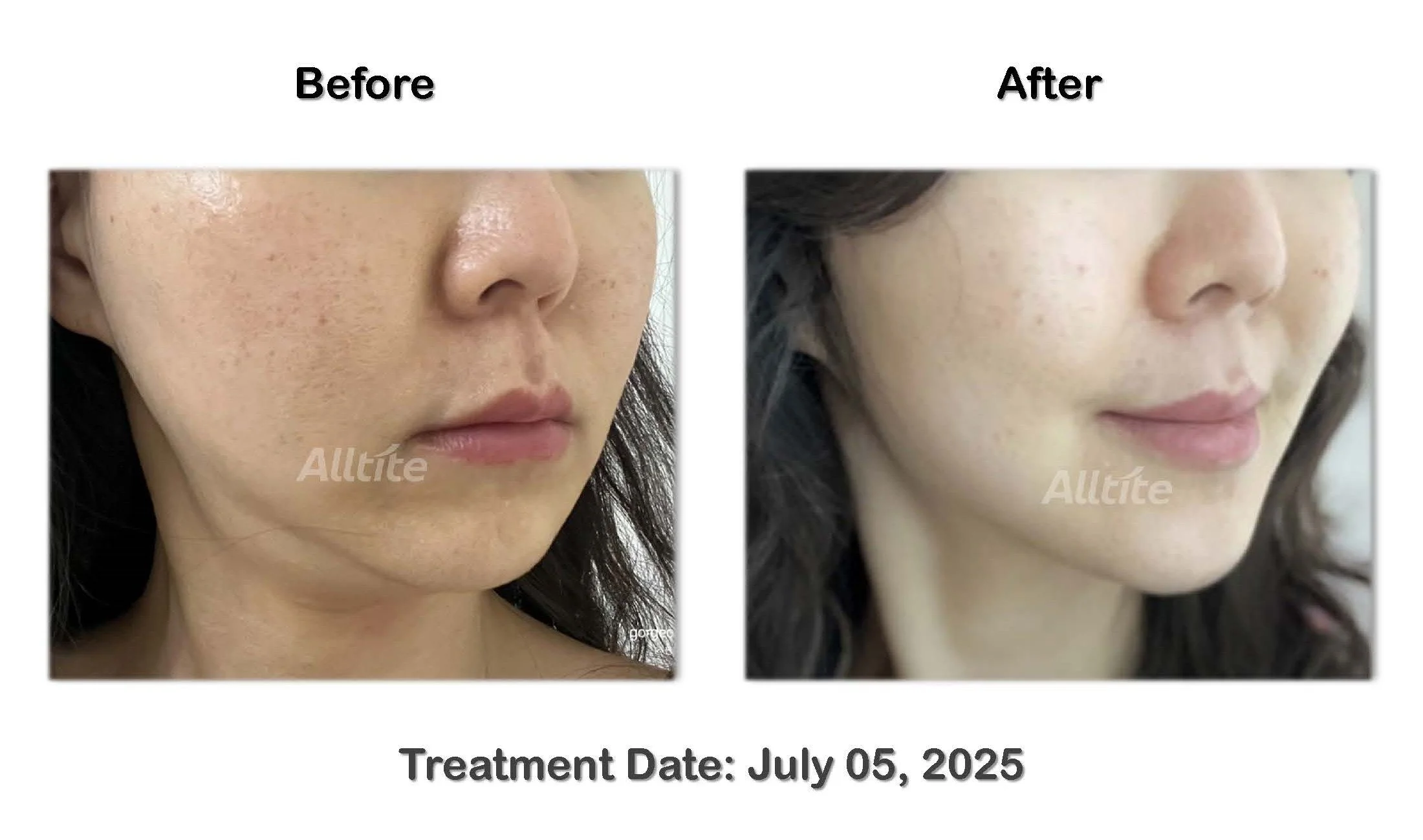 before and After (outgoing)_페이지_09.jpg