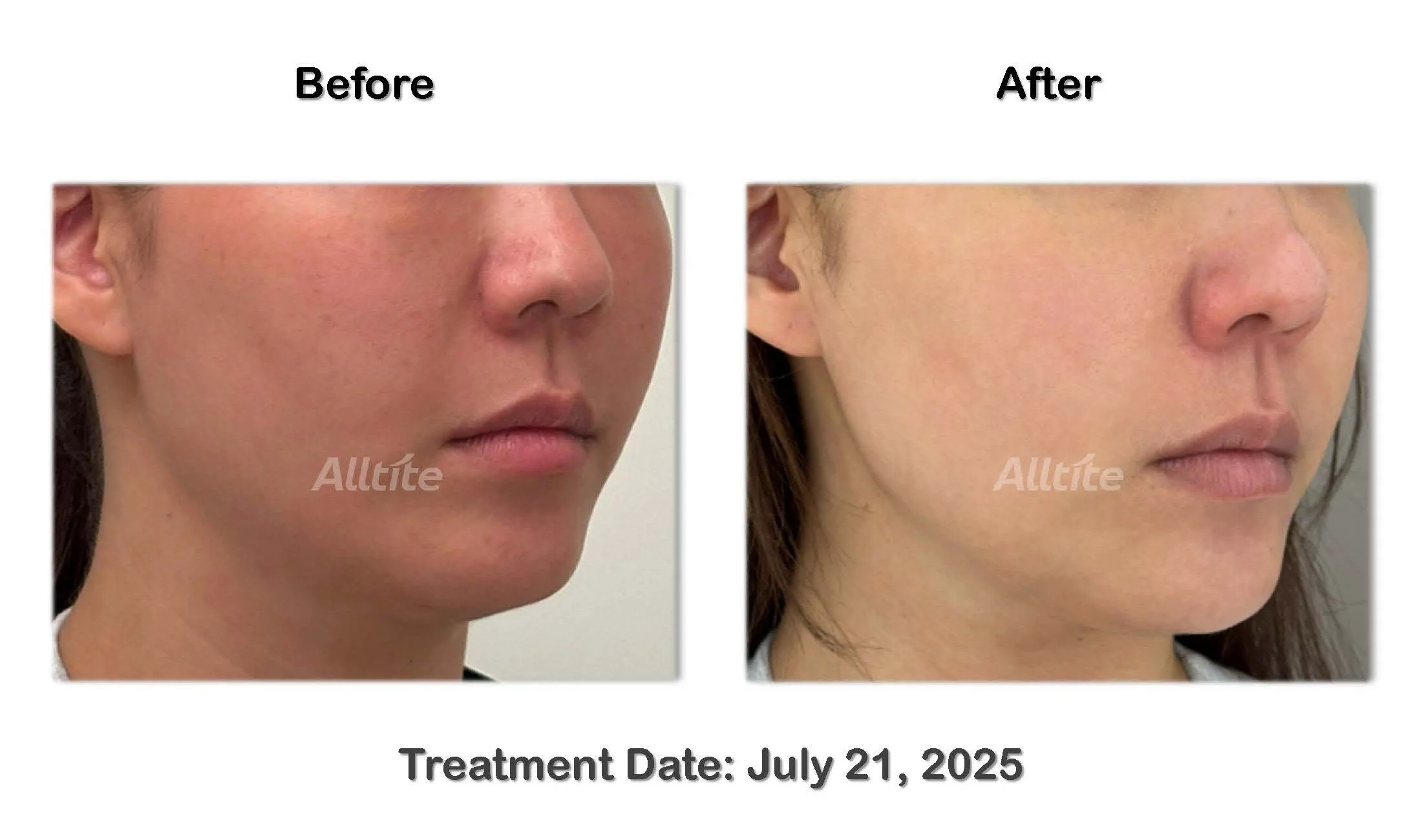 before and After (outgoing)_페이지_10.jpg