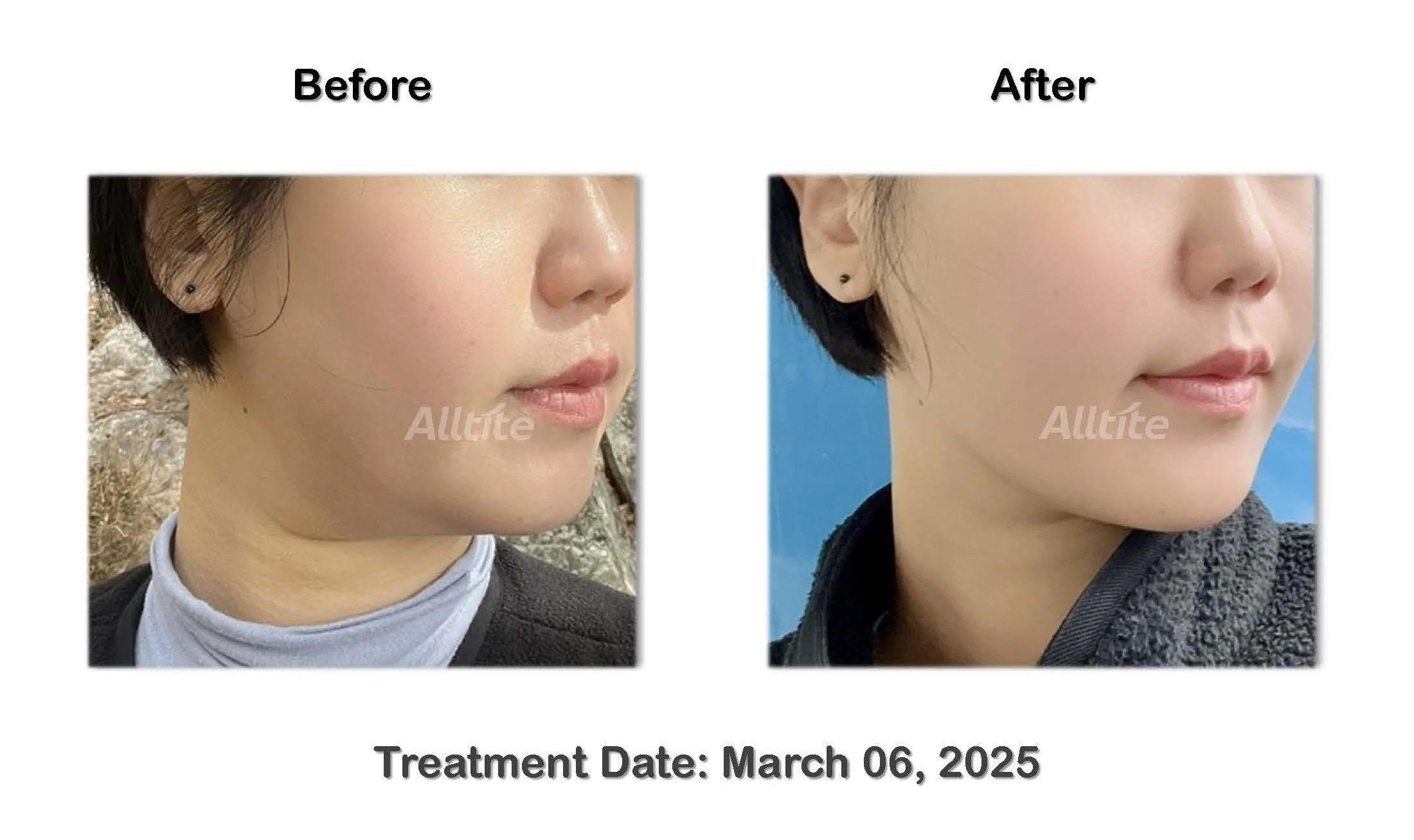 before and After (outgoing)_페이지_04.jpg