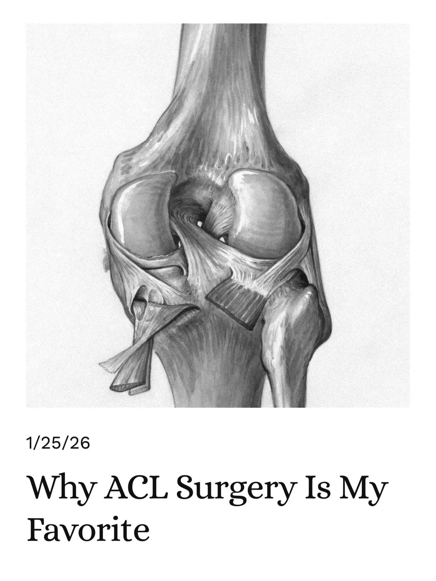 Published a BLOG section to the website..check it out and find out what my favorite surgery is!
🦴
#ACLsurgery #ACLreconstruction #KneeSurgery #OrthopedicSurgery #SportsInjury #KneeInjury #Orthopedics #ORTHOLife #PatientEducation #InformedPatients #S