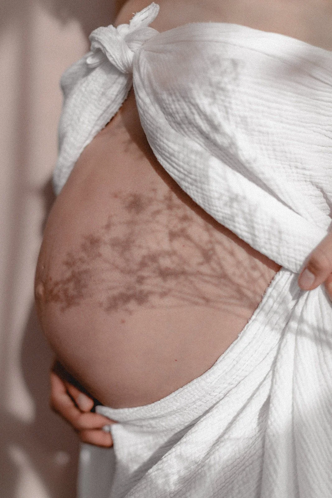 Nahaufnahme eines nackten Rückens mit Dehnungsstreifen, teilweise bedeckt von einem weißen Handtuch oder Kleidungsstück.