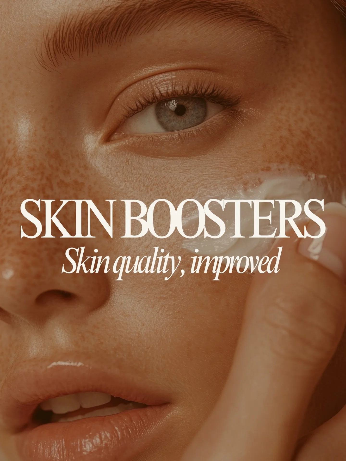 Healthy skin starts at the cellular level.

Fillmed NCTF is a next generation skin booster for the eyes and neck, designed to:

&bull; improve overall skin health
&bull; soften fine lines
&bull; revitalise and hydrates tired skin
&bull; reduce the ap