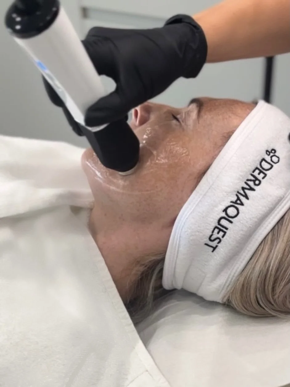 ✨ Looking for skin tightening without needles or downtime?

Pollogen by Lumenis uses advanced TriPollar&reg; radiofrequency technology to deliver controlled heat deep within the skin, reaching approximately 3mm below the surface.

This targeted energ