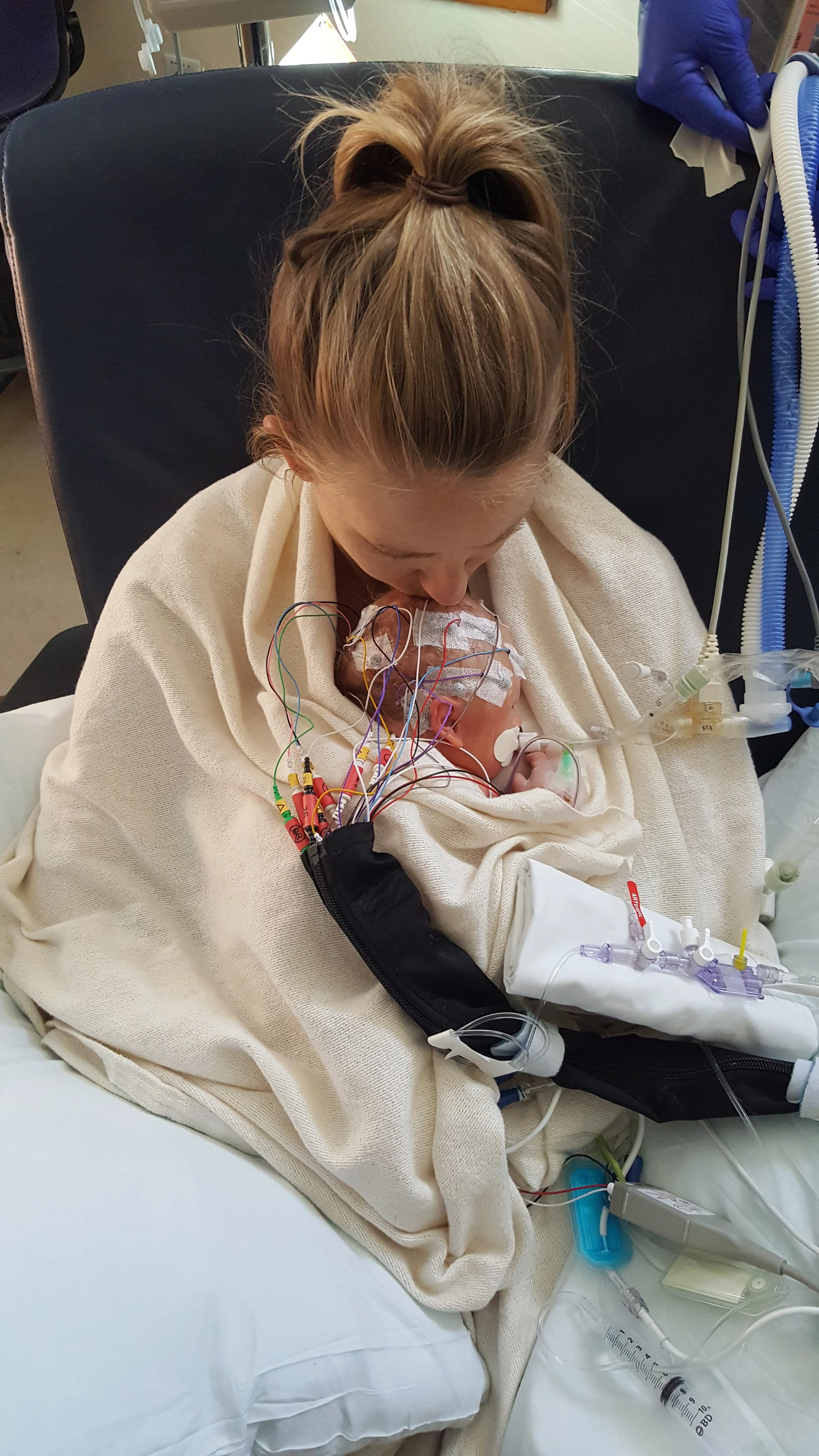 Processing the Cerebral Palsy Diagnosis - Initial Thoughts