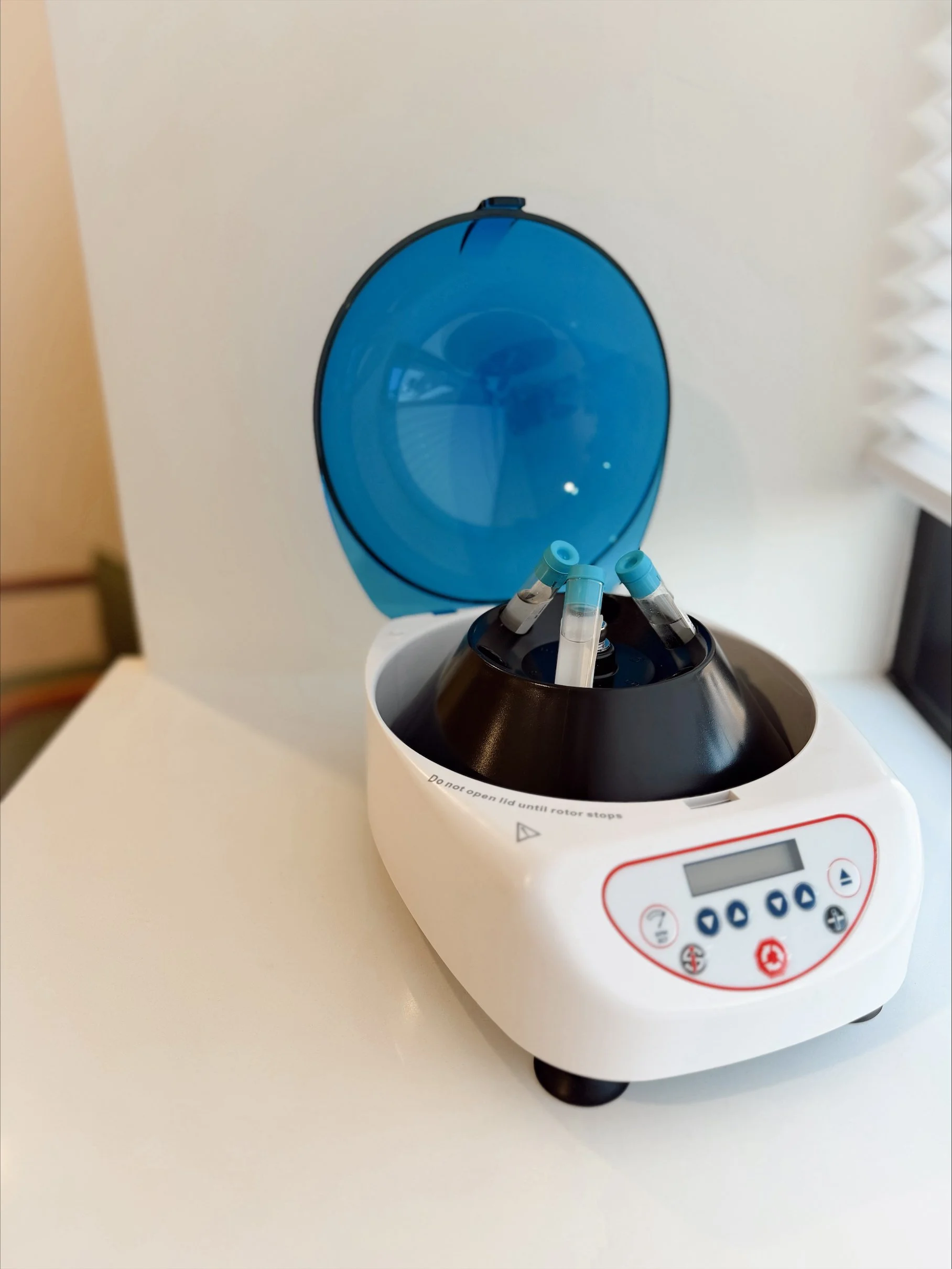 PRF Under-Eye Treatment: A Natural, Regenerative Approach to Brighter Eyes