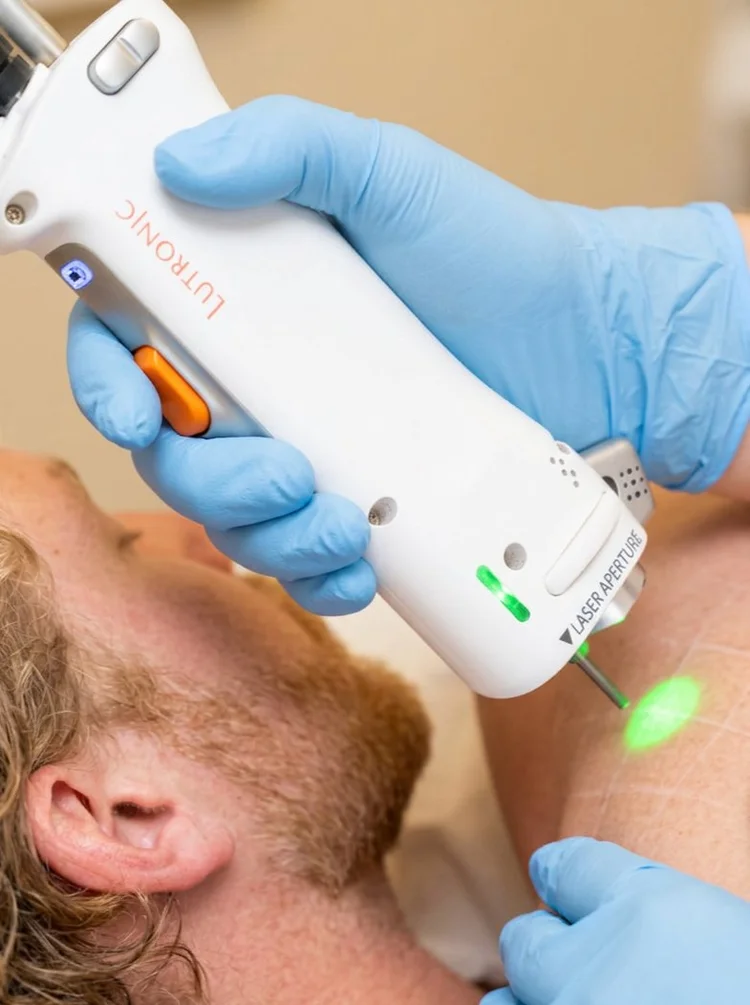 Pièce à main du laser Clarity II pendant une séance d'épilation laser du visage, cabinet du Dr Samson à Évian
