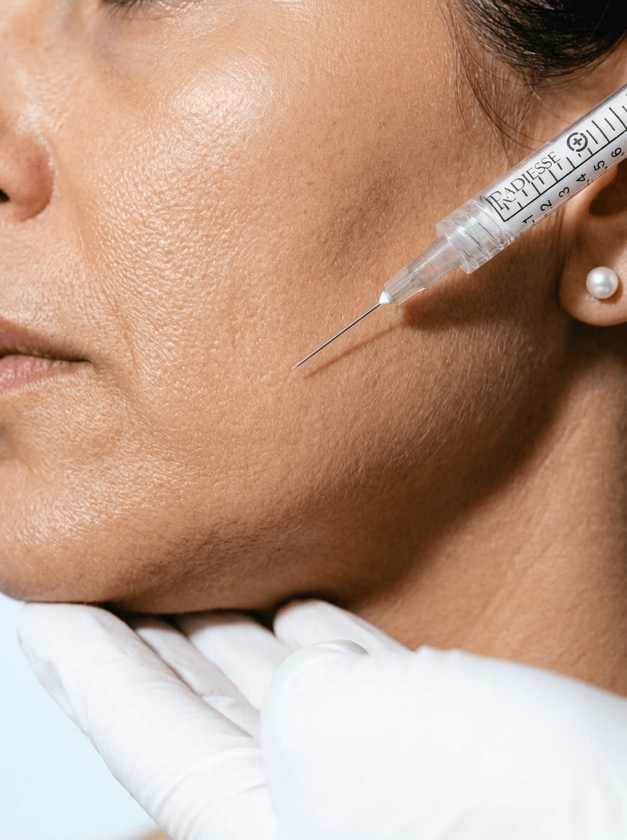 Injection Radiesse de l'ovale du visage, redensification au cabinet du Dr Samson à Évian