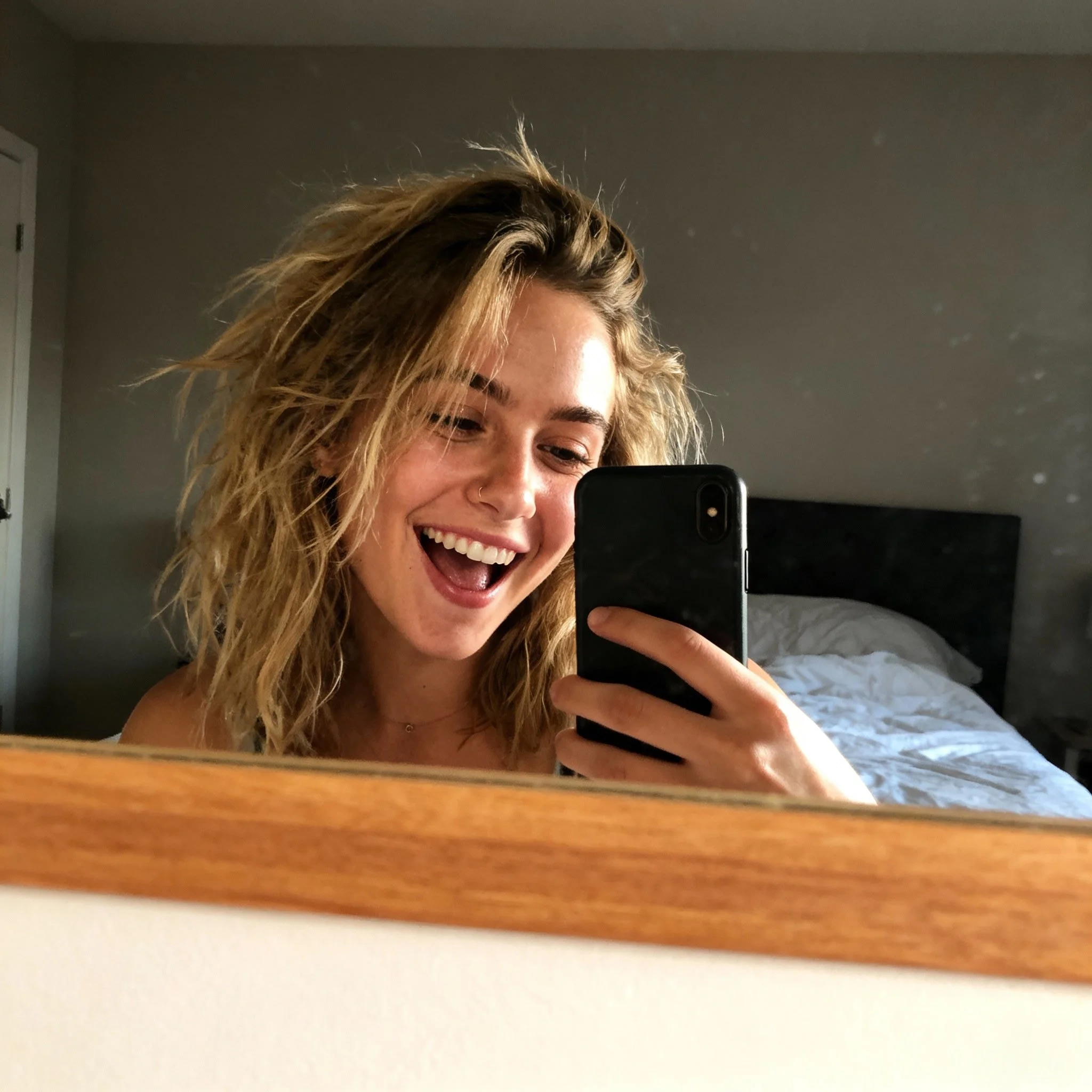 Avis patiente Profhilo au cabinet de médecine esthétique du Dr Samson à Évian