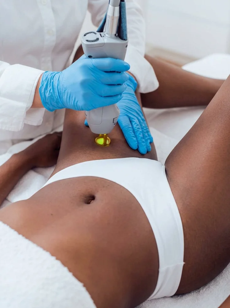 Épilation laser sur peau foncée avec le Clarity II, cabinet du Dr Samson à Évian