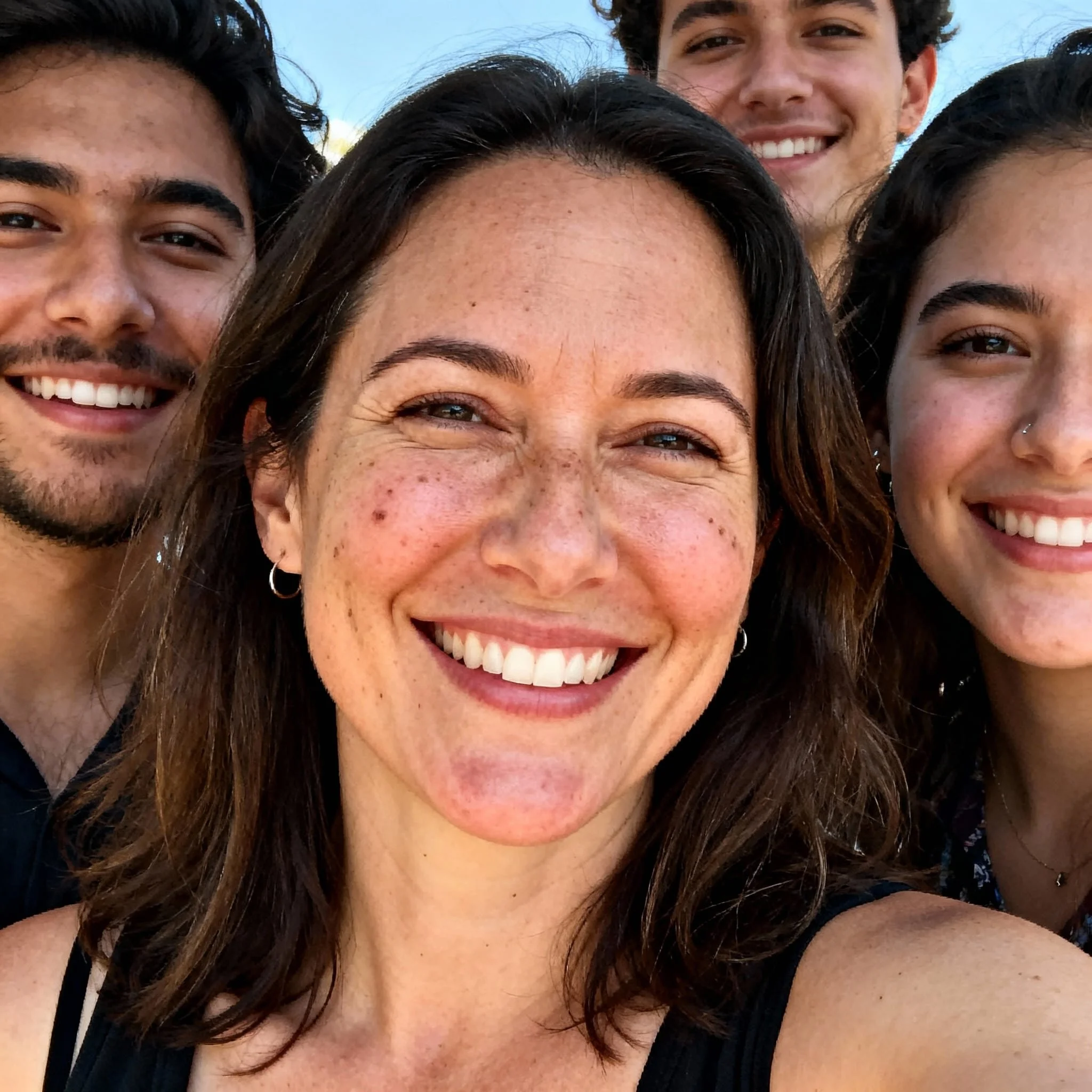 Portrait d’une jeune femme présentant des cicatrices d’acné pigmentées, illustrant un traitement laser Enlighten pour atténuer l’hyperpigmentation post-inflammatoire
