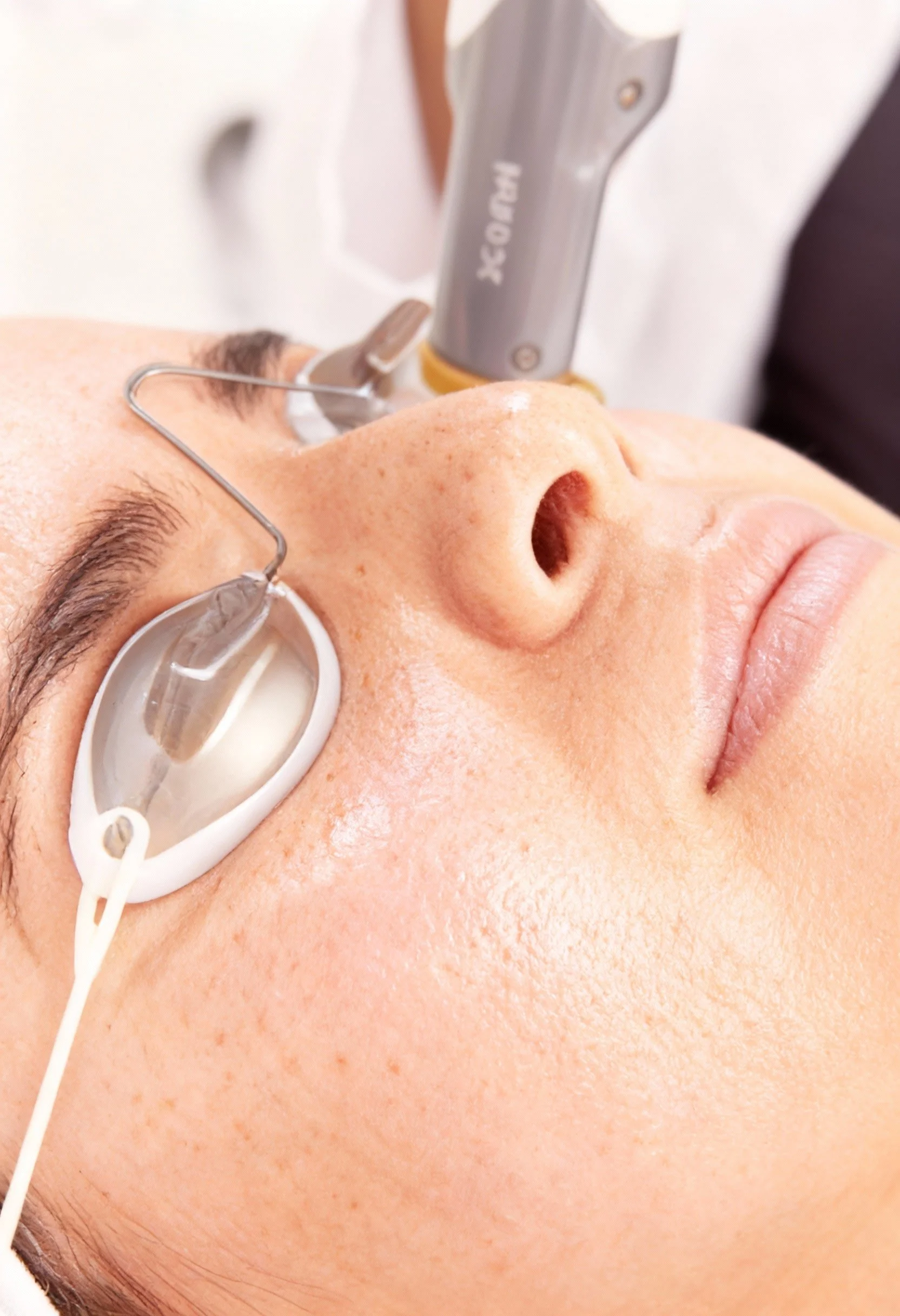 Traitement laser anti-âge visage Enlighten au cabinet du Dr Samson