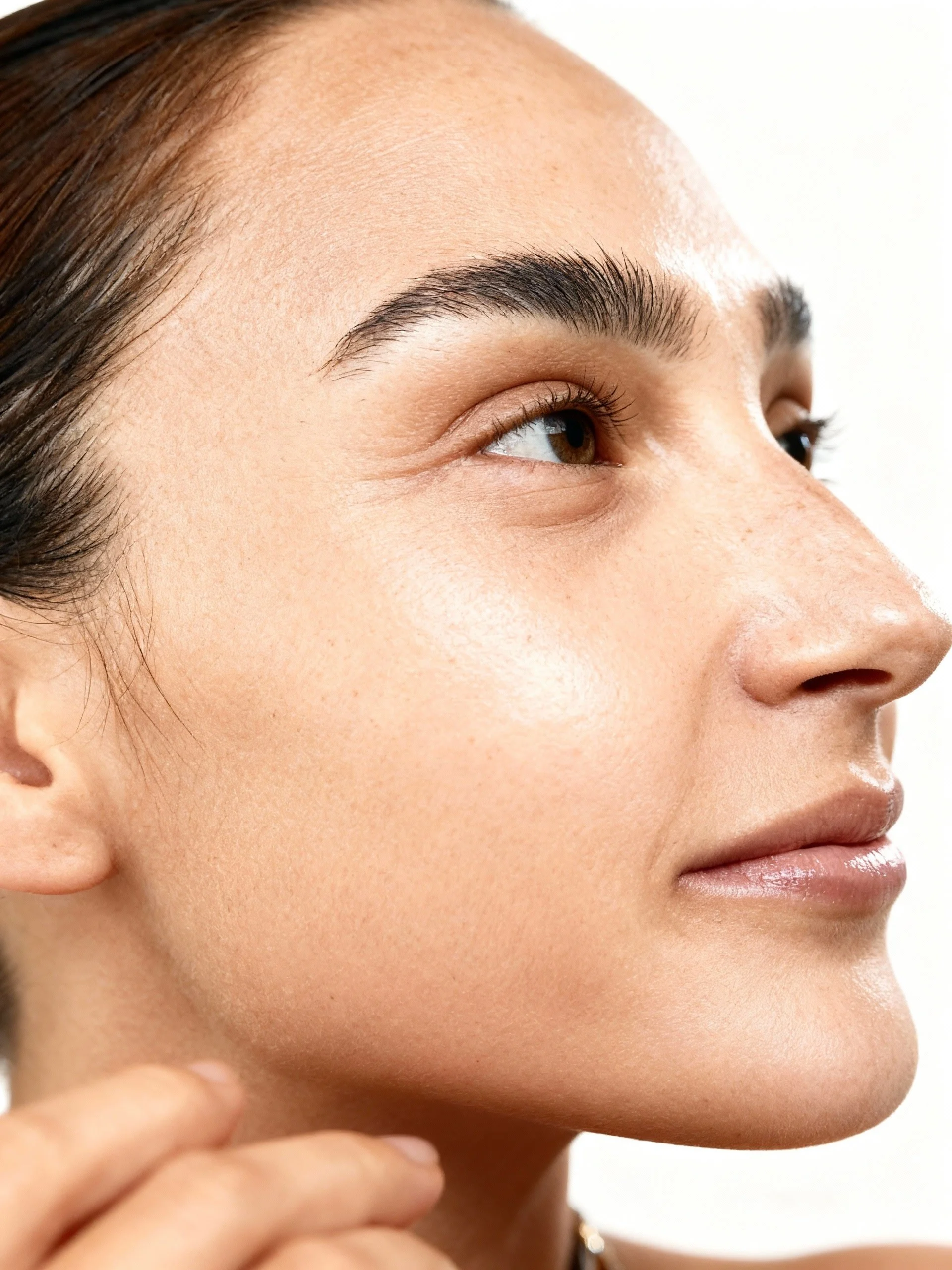 Résultat Profhilo : peau lissée, lumineuse et hydratée en profondeur grâce au bio-remodelage