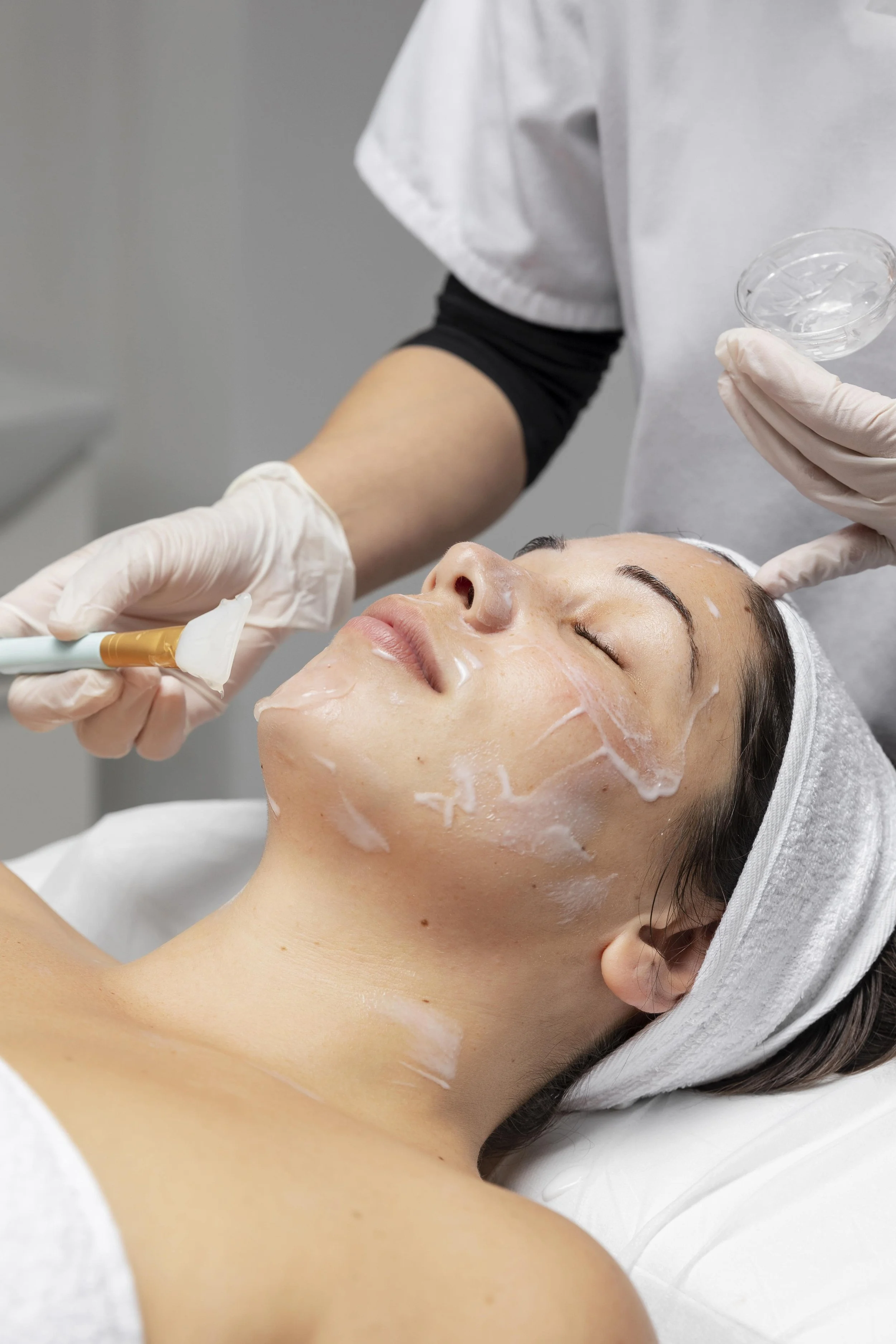 Peeling médical professionnel pour améliorer la qualité de peau à Évian
