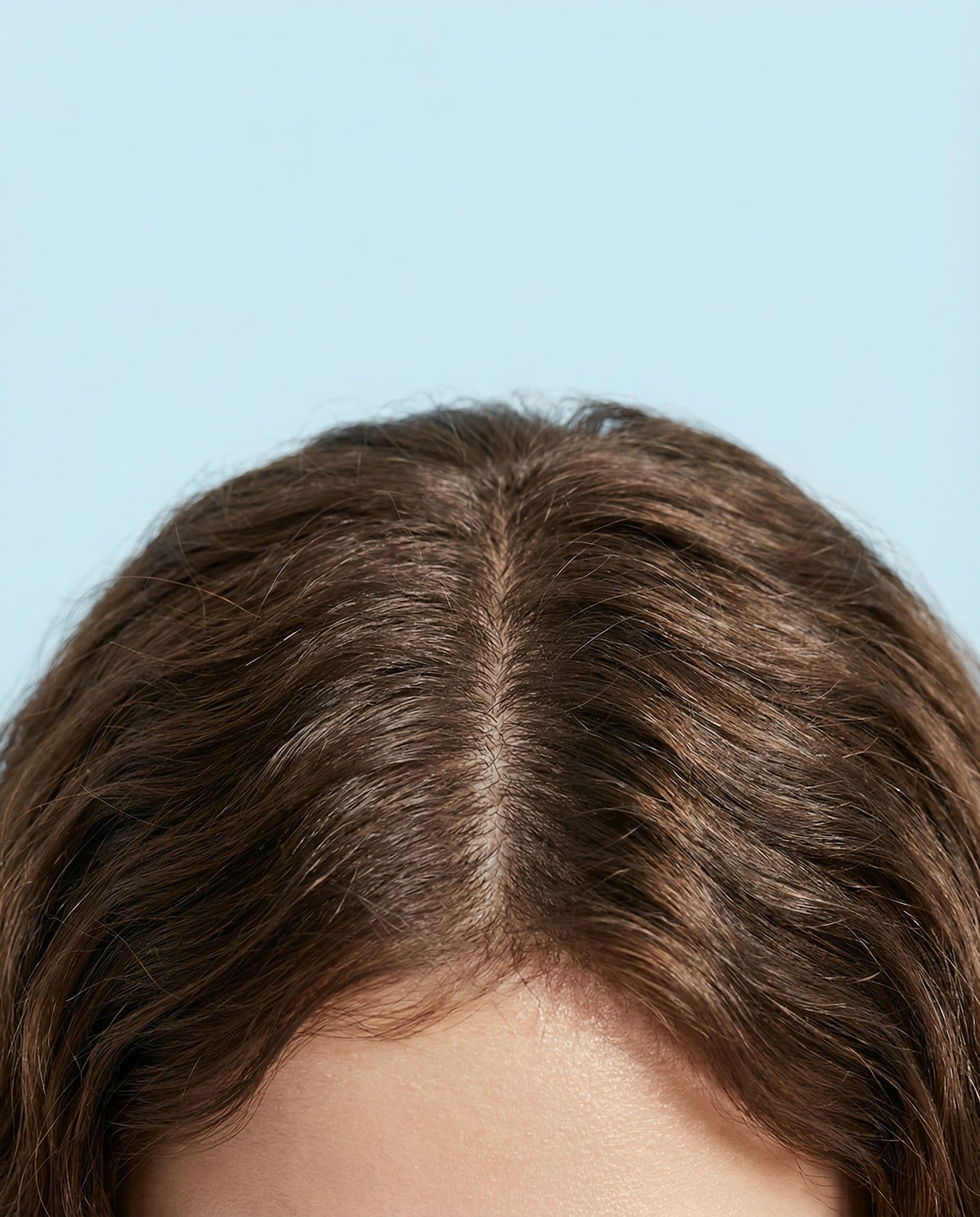 Observation du cuir chevelu après traitement facteurs de croissance – suivi médical et repousse progressive