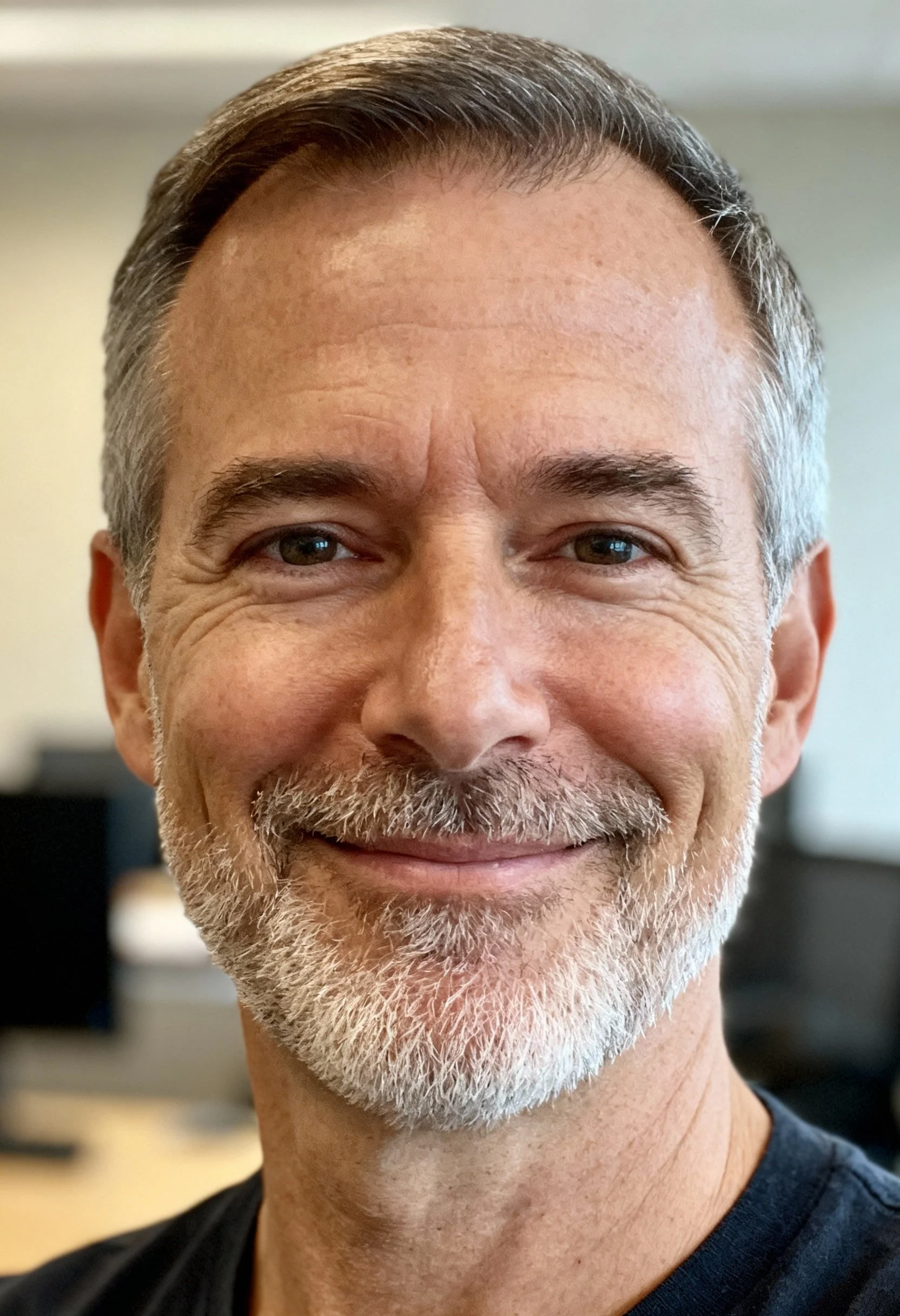 Portrait naturel d’un patient  Julien– retour d’expérience sur le traitement régénératif pour la chute de cheveux au cabinet Dr Samson à Évian