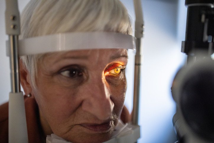 Age‑Related Macular Degeneration (AMD)