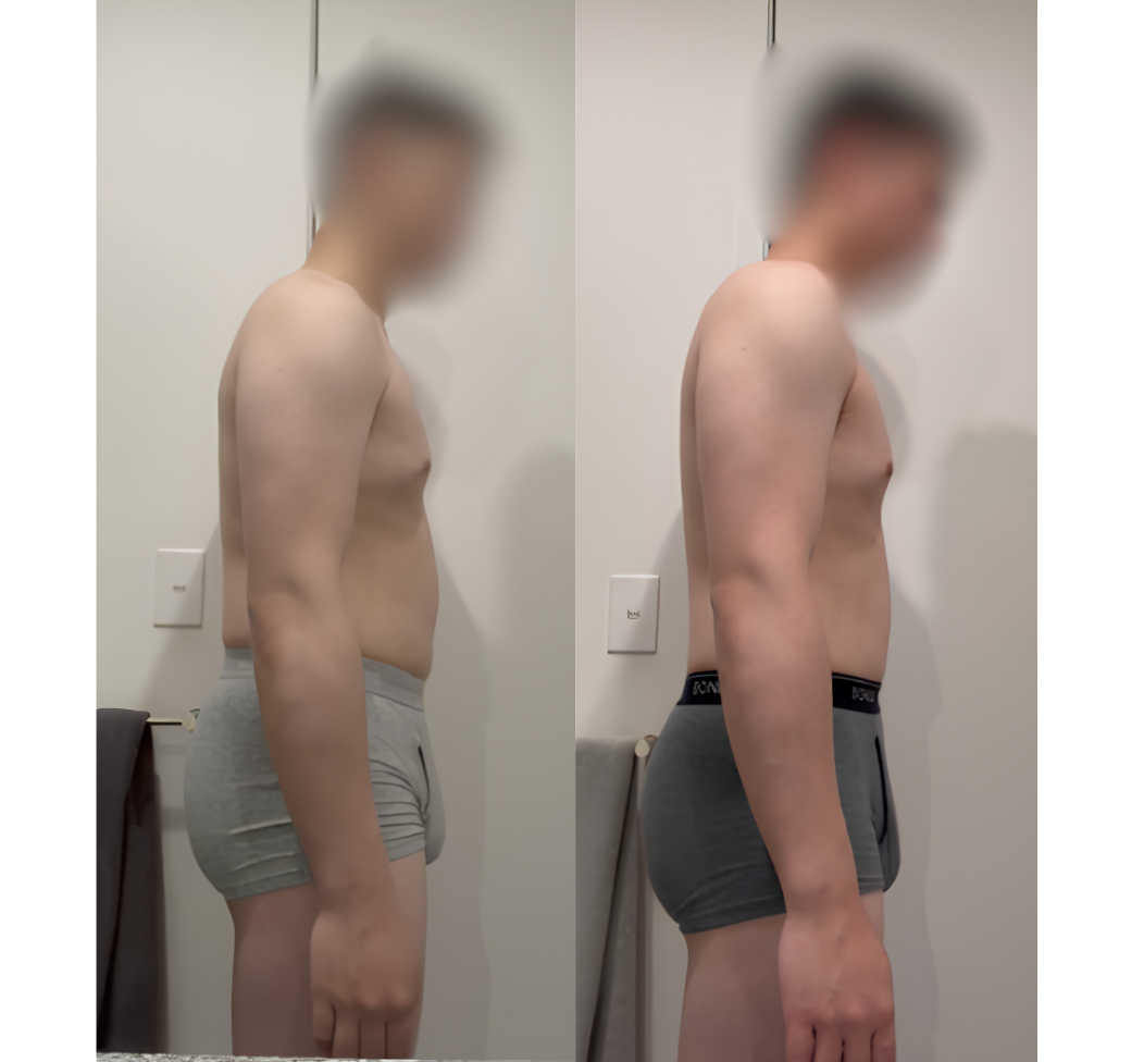 Fat Loss vs Weight Loss, The Simplest Explanation Ever.
