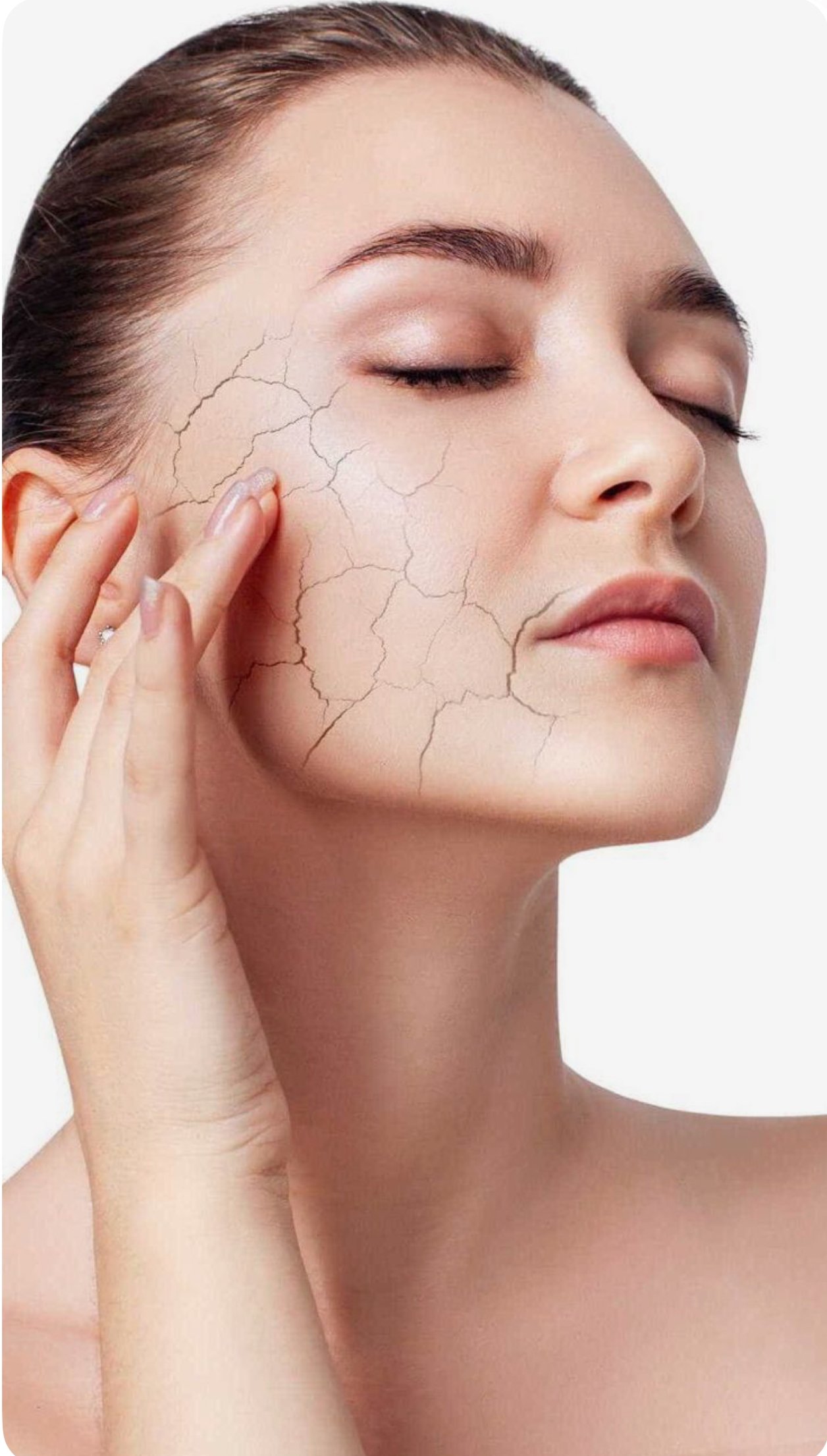 Close-up of a woman with dry skin, touching her face with her fingers, showing cracks on her cheek and chin.