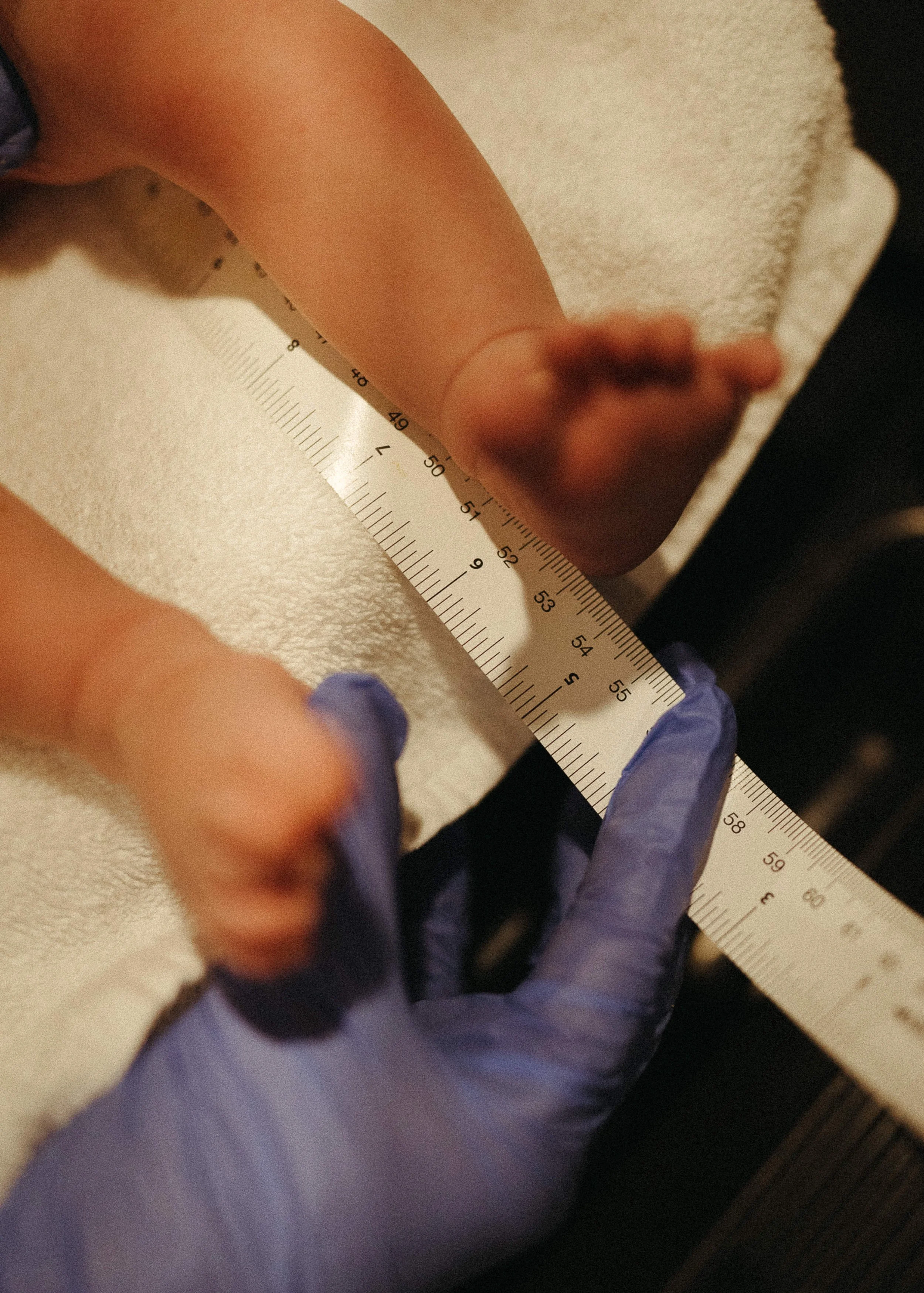 Close-up of a person's arm and hand, wearing purple gloves, holding a white ruler on a white textured surface with another person's arm visible in the background.