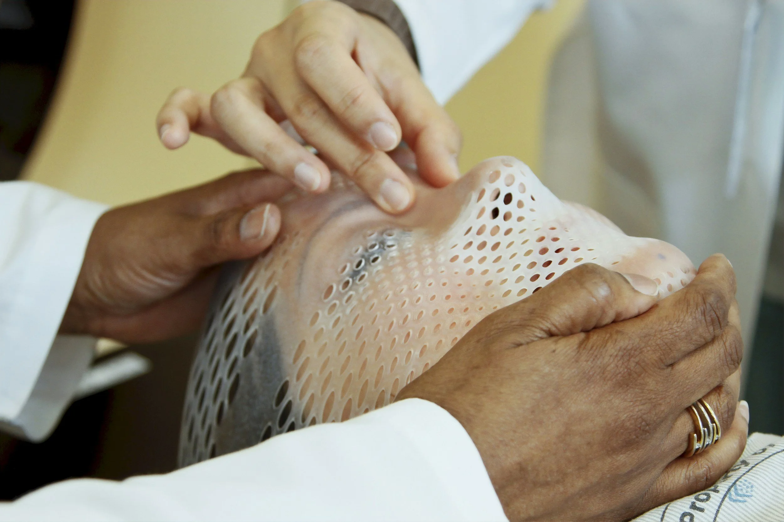 Hands of a person fitting a transparent, patterned silicone mask over another person's face.