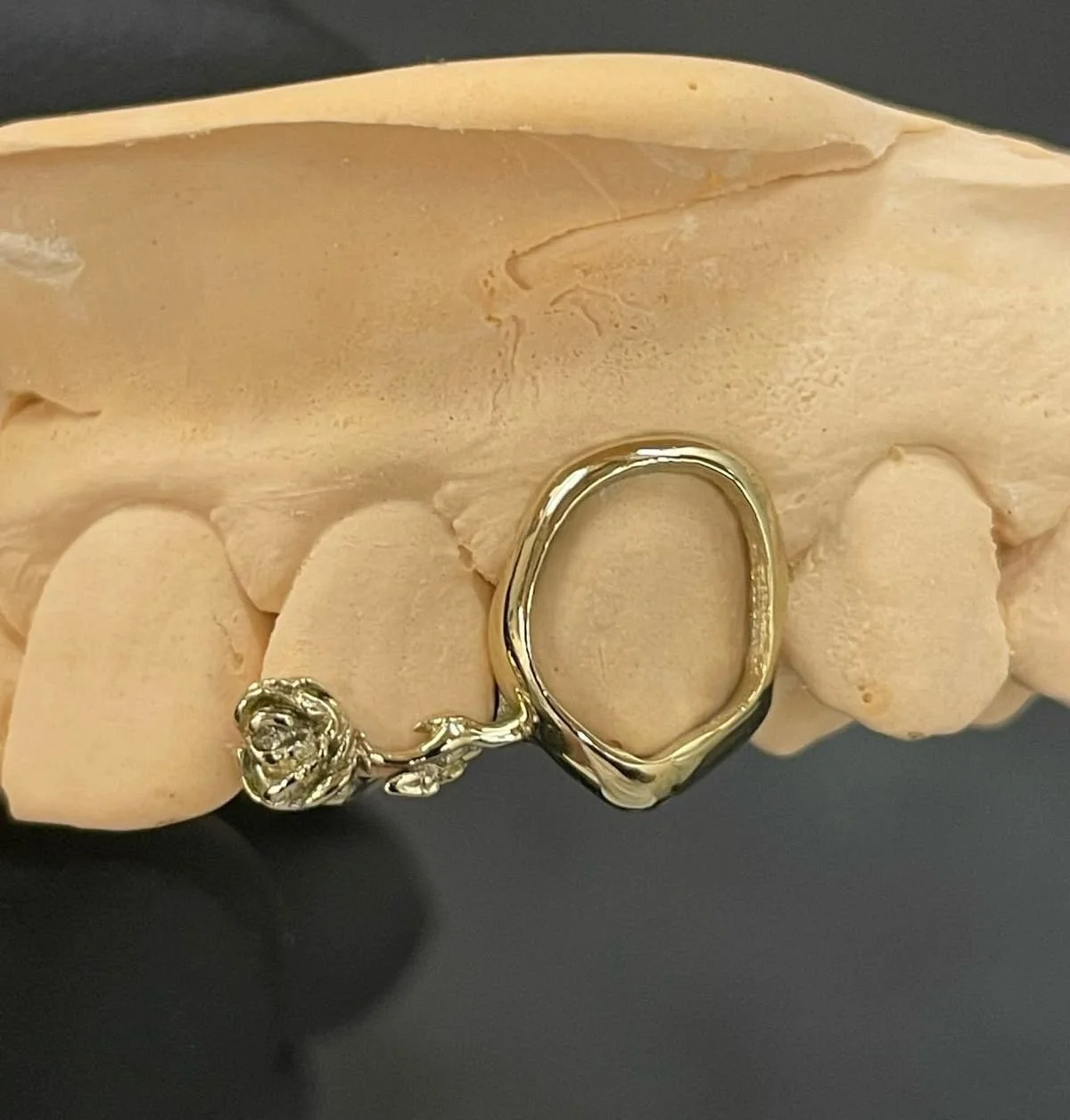 grillz letter impression