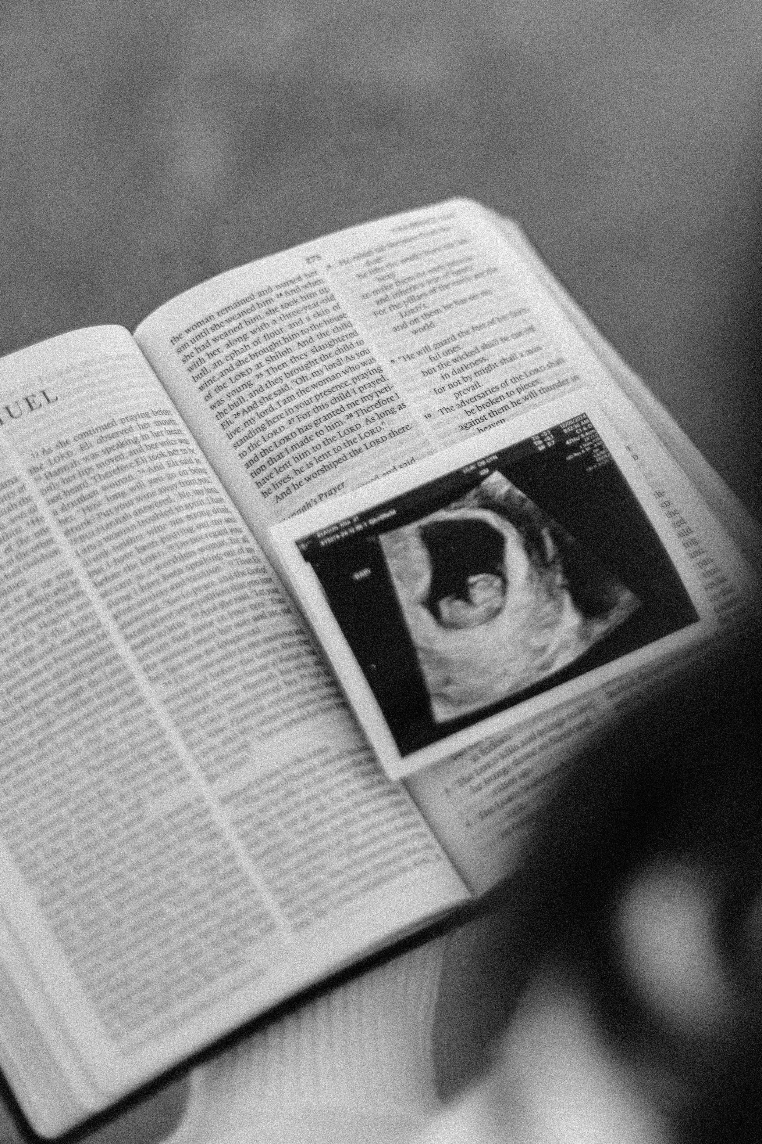 An open Bible with a pregnancy ultrasound image taped inside, in black and white.