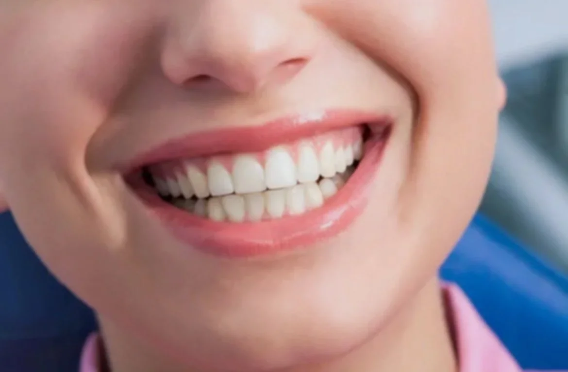 Air flow- Perché è diversa dalla pulizia “normale”