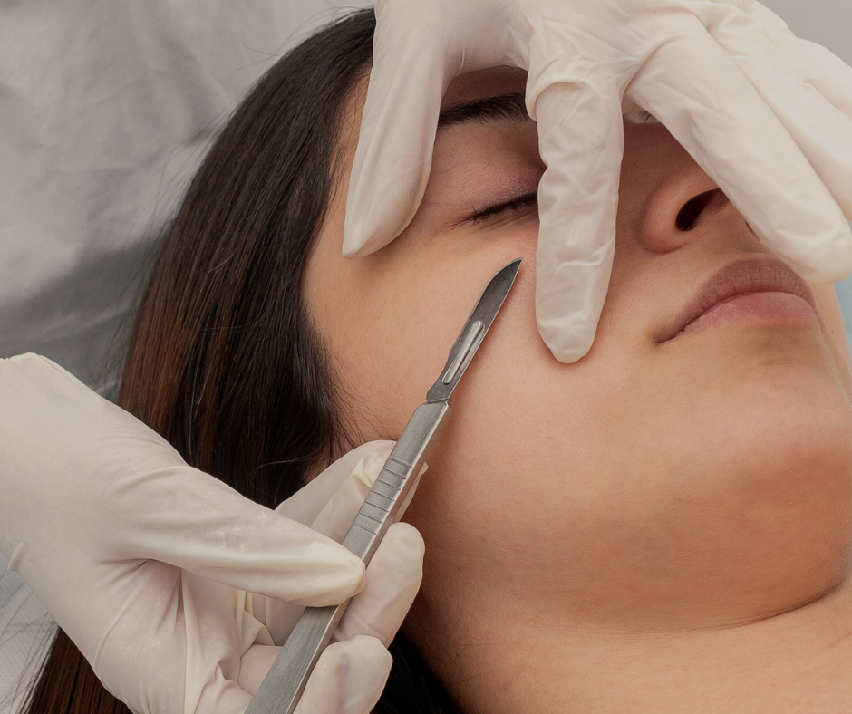 A person receiving a cosmetic surgical procedure on their cheek, with a medical professional using a scalpel, while wearing gloves.