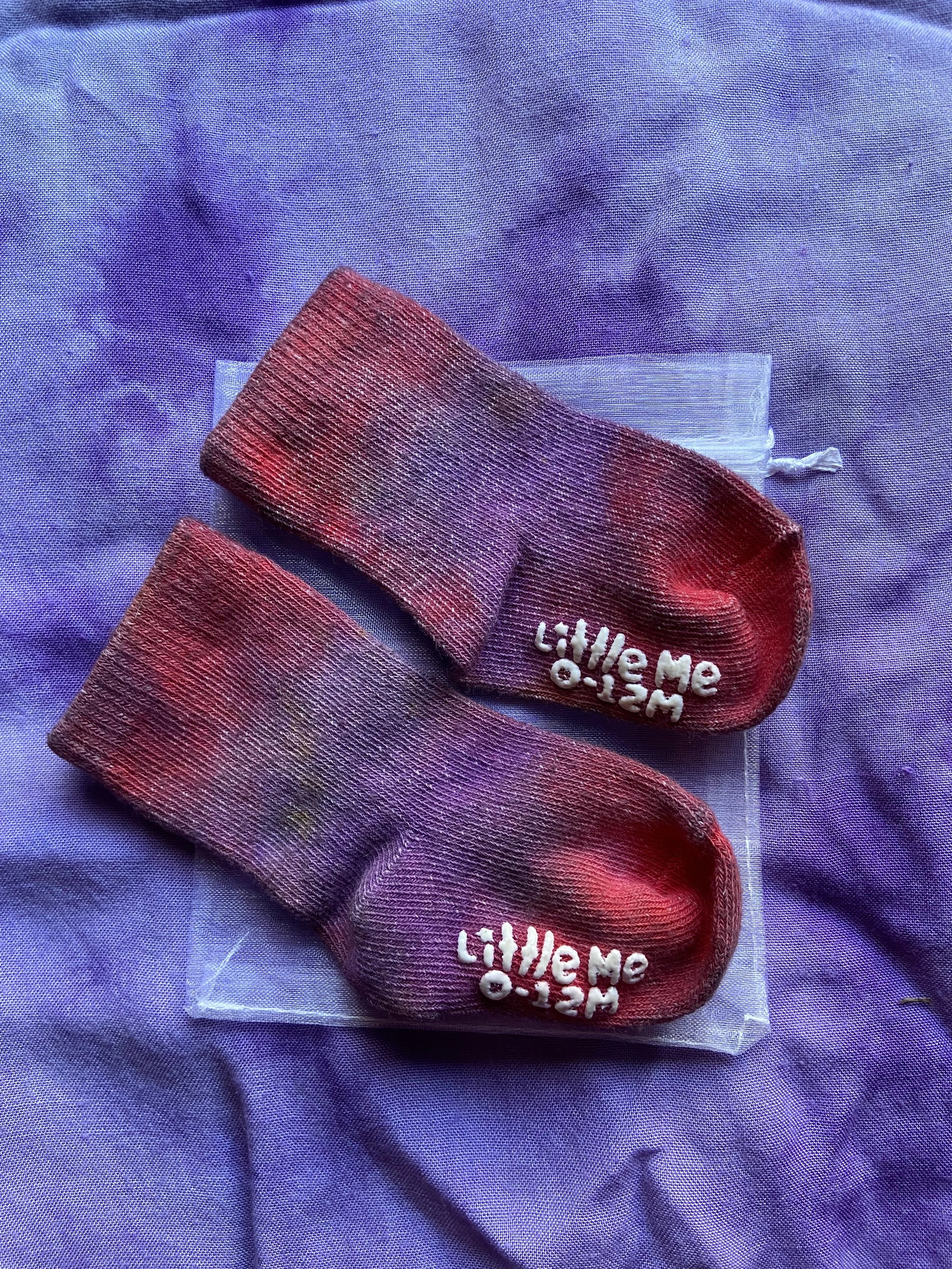 Strawberry Tie-Dye Socks