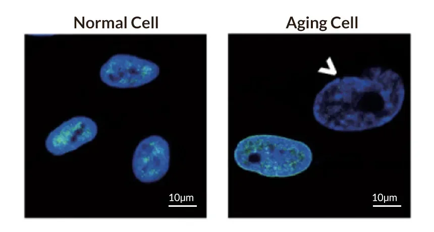  The Science of Aging: How Cellular Changes Impact Longevity After 40