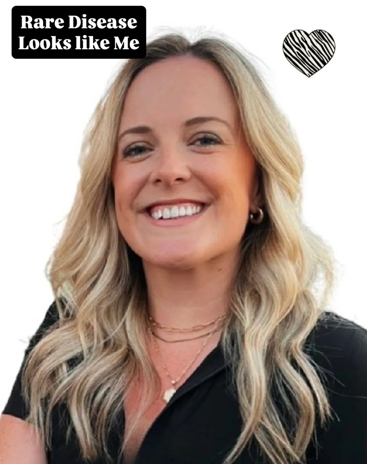 A woman with blonde, wavy hair smiling, wearing a black top and layered gold necklaces. Text overlay reads 'Rare Disease Looks like Me' with a black and white striped hearts graphic.