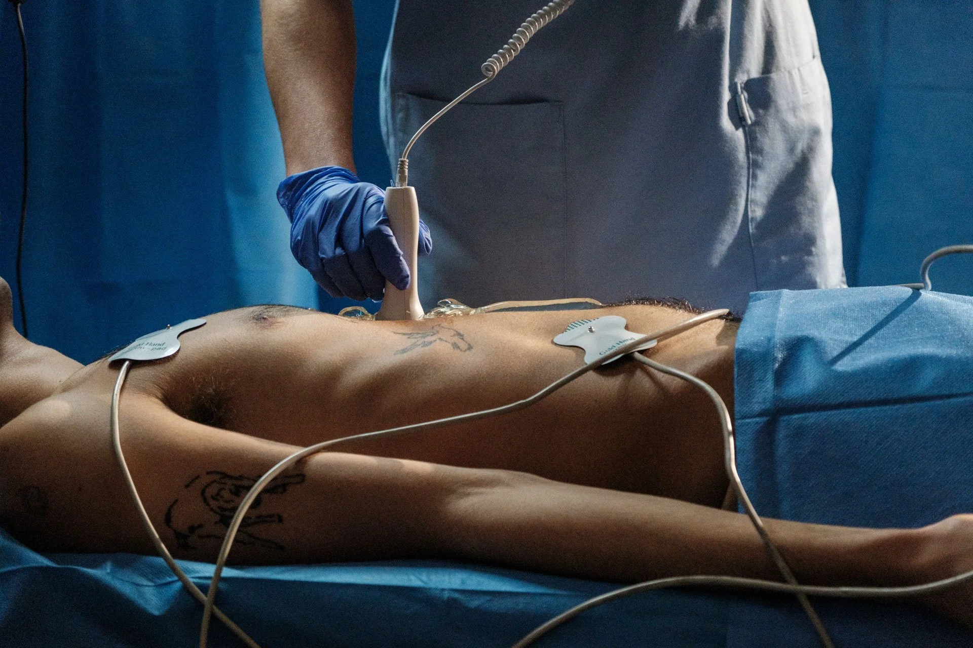 Une personne allongée sur une table d'opération lors d'une intervention chirurgicale, un médecin utilisant un appareil médical. La scène semble se dérouler dans une salle d'opération avec des dispositifs médicaux reliés à la personne.